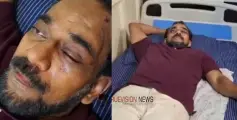 #Attack | വടകരയിൽ ആറംഗ സംഘത്തിൻ്റ അക്രമണം; അധ്യാപകന് ഗുരുതര പരിക്ക്, സംഘത്തില്‍ വിദ്യാര്‍ത്ഥിയും