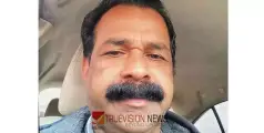 ഇന്ന് നാട്ടിലേക്ക്‌ പോകാനിരുന്ന മലയാളി ദമ്മാമില്‍ കുഴഞ്ഞ് വീണ്‌ മരിച്ചു