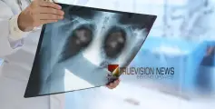 റേഡിയോളജി വിഭാഗം; എംആർഐ -സിടി  സ്കാനിം​ഗുകൾക്ക് 30% വരെ ഇളവുകളുമായി പാർകോ