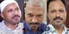തലമുടി പിടിപ്പിക്കൽ ചികിത്സയെ തുടർന്ന് അണുബാധ ഉണ്ടായ സംഭവത്തിൽ പൊലീസ് കേസെടുത്തു