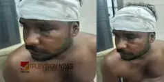 ഫുട്ബോൾ മത്സരത്തിനിടെ തർക്കം, യുവാവിന് ക്രൂരമര്‍ദനം; തലയ്ക്കും കണ്ണിനും ഗുരുതര പരിക്ക്