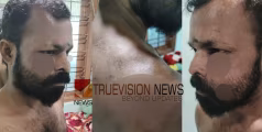 ബോധംപോയി തുടങ്ങിയോ? ബിയർ കുപ്പി കൊണ്ട് മർദ്ദിച്ചു,  മസ്തിഷ്ക സംബന്ധമായ രോഗമുള്ളയാൾക്ക് നേരെ പൊലീസിന്റെ ക്രൂരമർദ്ദനമെന്നു പരാതി