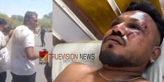 'എല്ലാം പെട്ടെന്നായിരുന്നു, ഞാന്‍ എഴുന്നേറ്റപ്പോള്‍ എനിക്ക് ചുറ്റും മൃതദേഹങ്ങളായിരുന്നു, അവിടെനിന്ന് എഴുന്നേറ്റ് ഓടുകയായിരുന്നു' - ജീവനോടെ ബാക്കിയായ രമേഷ്
