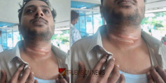 ബൈക്കിൽ പോകുന്നതിനിടെ ഇന്‍റര്‍നെറ്റ് കേബിള്‍ പൊട്ടിവീണ് കഴുത്തിൽ കുടുങ്ങി, അധ്യാപകന് പരിക്ക്