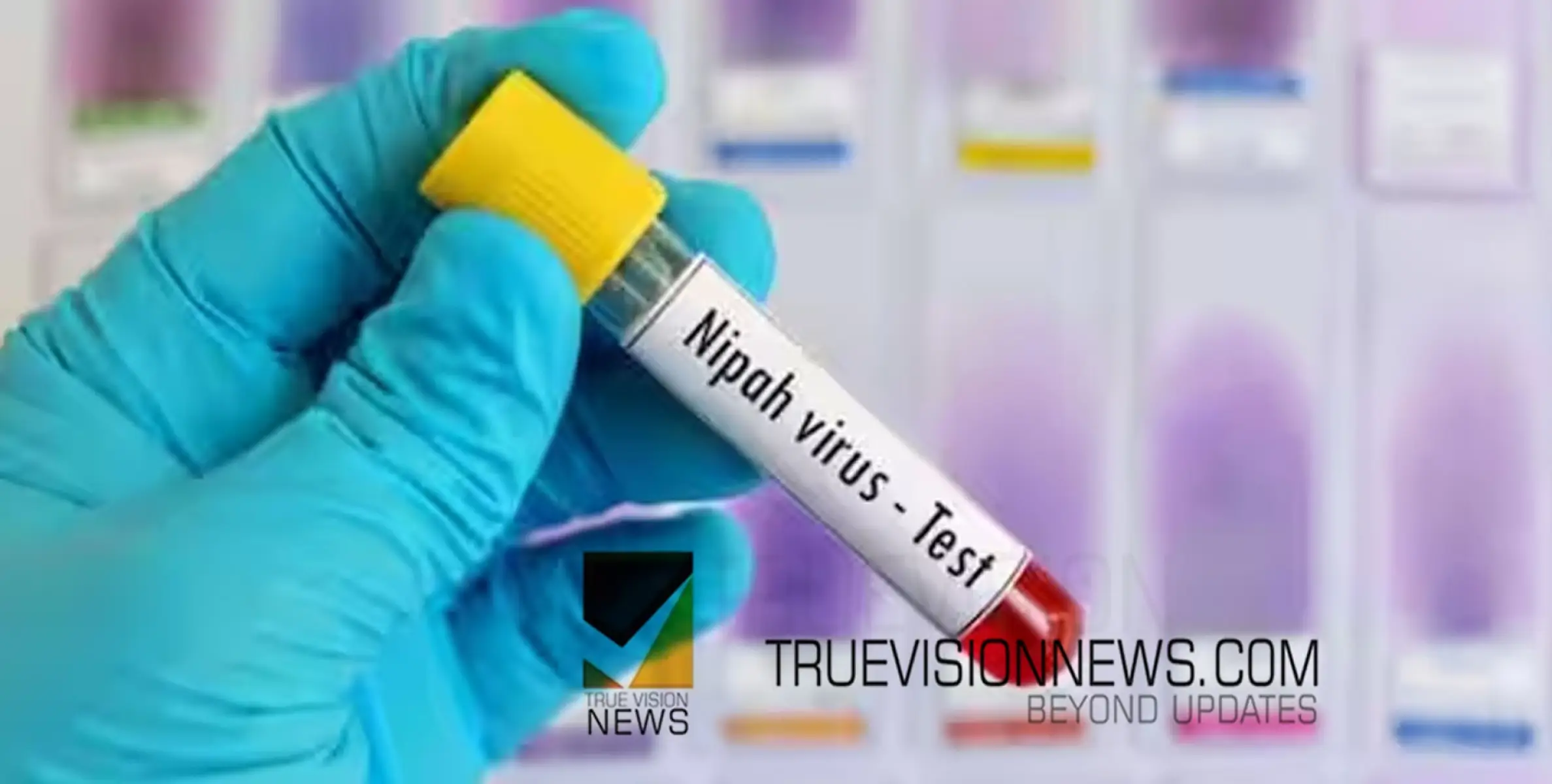#feverdeath |  കോഴിക്കോട് അസ്വാഭാവിക പനി മരണം, നിപയെന്ന് സംശയം,  ജില്ലയില്‍ ആരോഗ്യ ജാഗ്രത