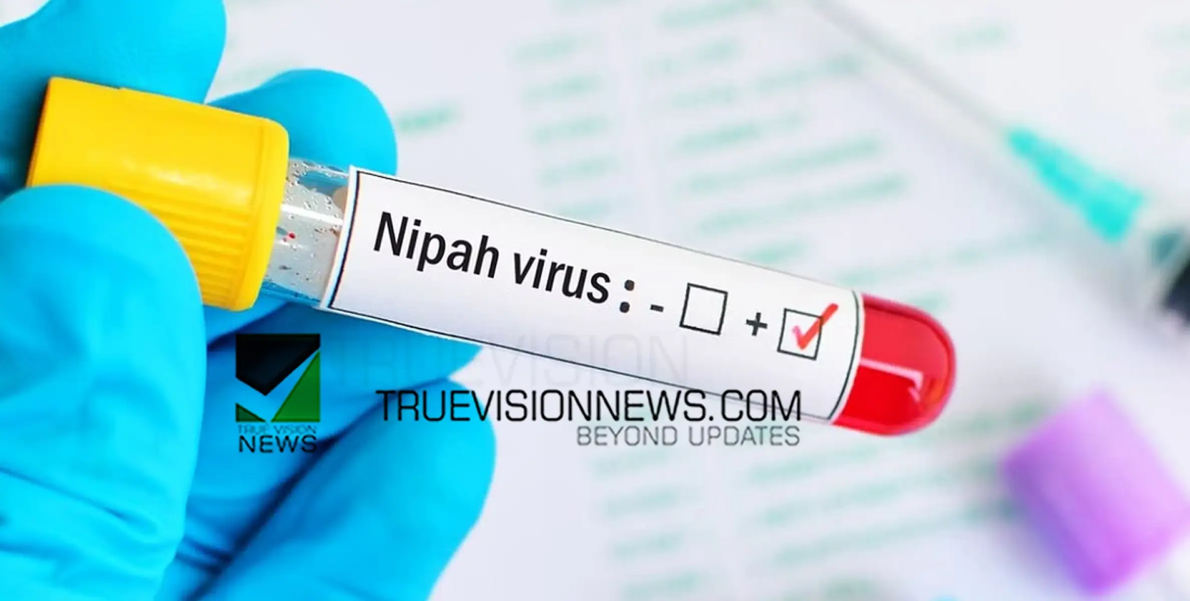 #NIPAH |  സംസ്ഥാനത്ത്  നിപ ബാധ സ്ഥിരീകരിച്ചു