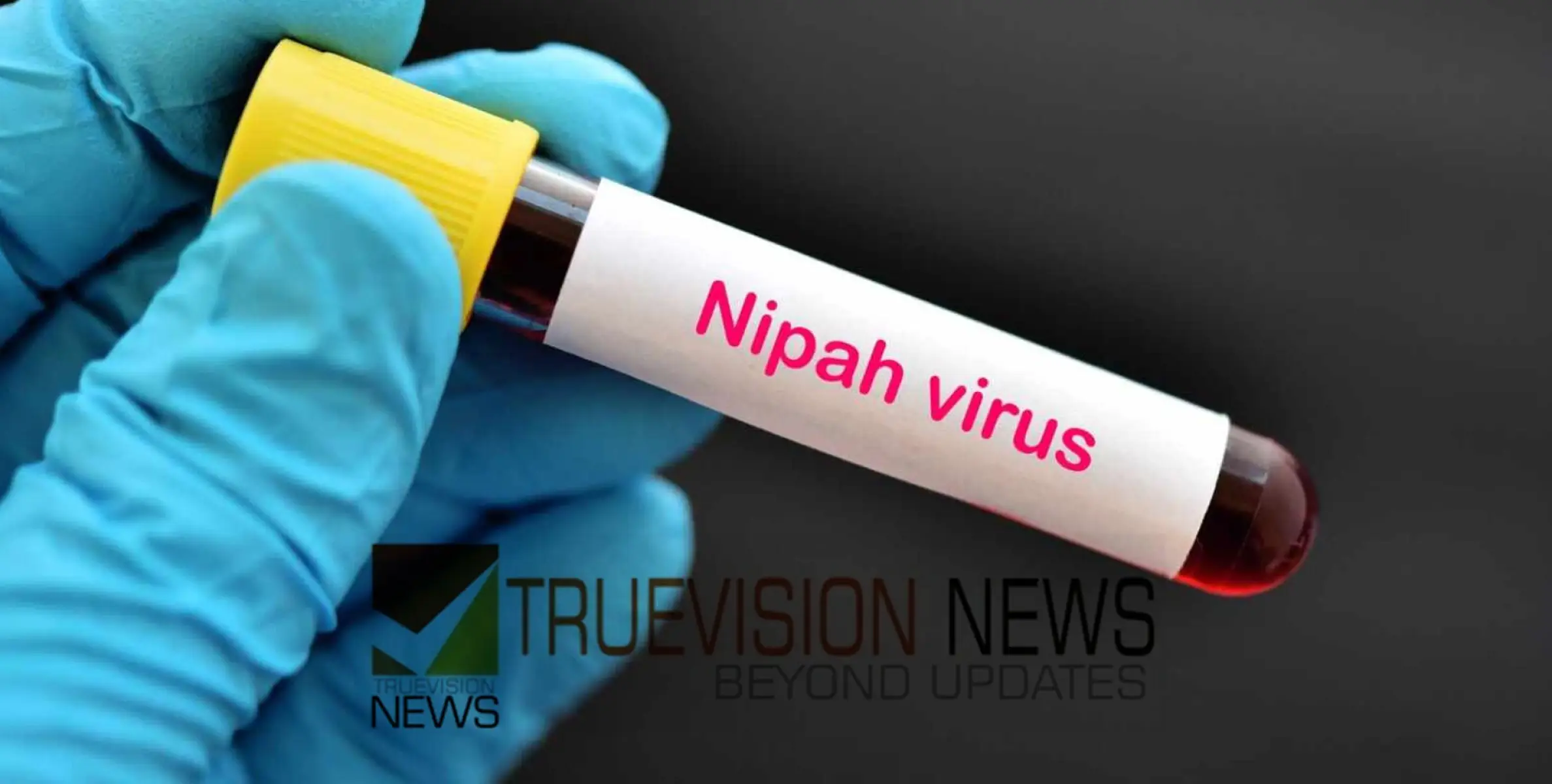 #nipah | തോന്നയ്ക്കൽ വൈറോളജി ഇൻസ്റ്റിറ്റ്യൂട്ടിലെ ആദ്യ നിപ പരിശോധനാഫലം,  മെഡിക്കൽ വിദ്യാർത്ഥി നിപ നെഗറ്റീവ്
