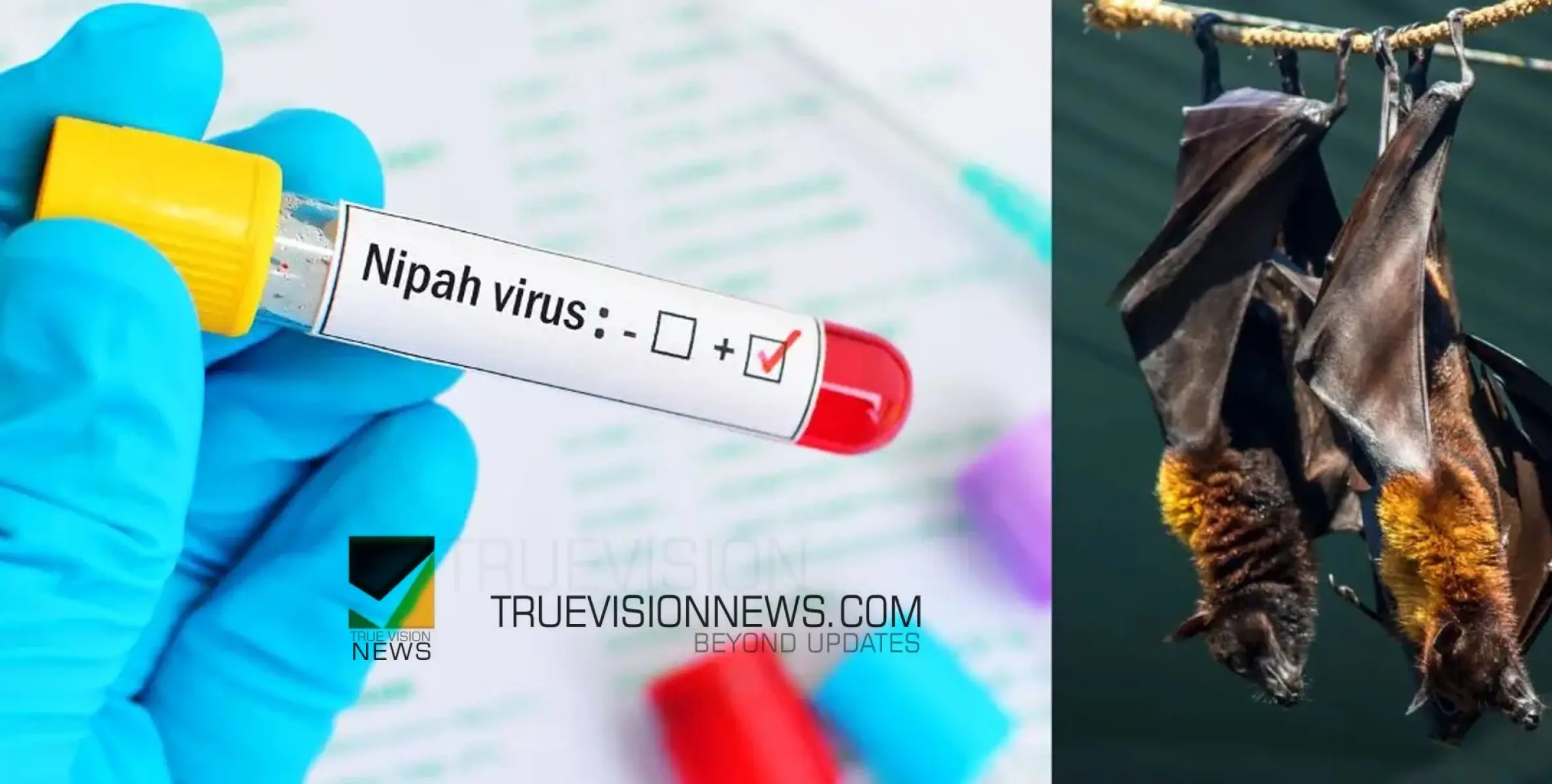 #nipah | നിപ: ഇന്ന് നിപ സ്ഥിരീകരിച്ചത് കോഴിക്കോട് ചെറുവണ്ണൂർ സ്വദേശിക്ക്
