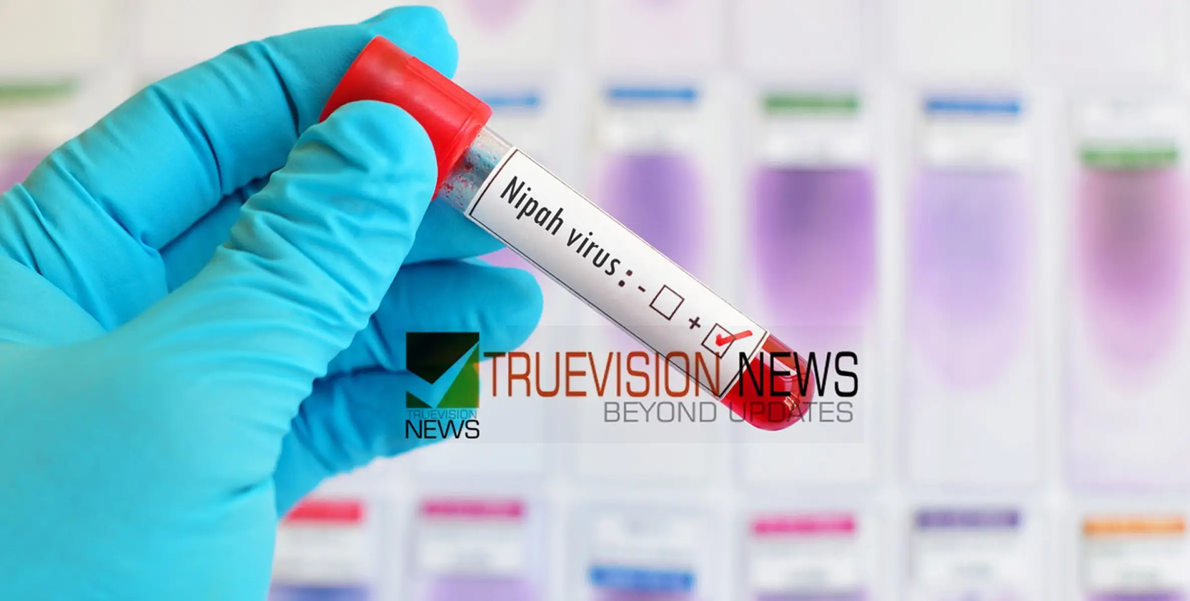 #nipah | നിപ പ്രതിരോധം; വനം വകുപ്പിന്റെ പ്രവര്‍ത്തനങ്ങളെ ഏകോപിപ്പിക്കാന്‍ പ്രത്യേക സമിതി 