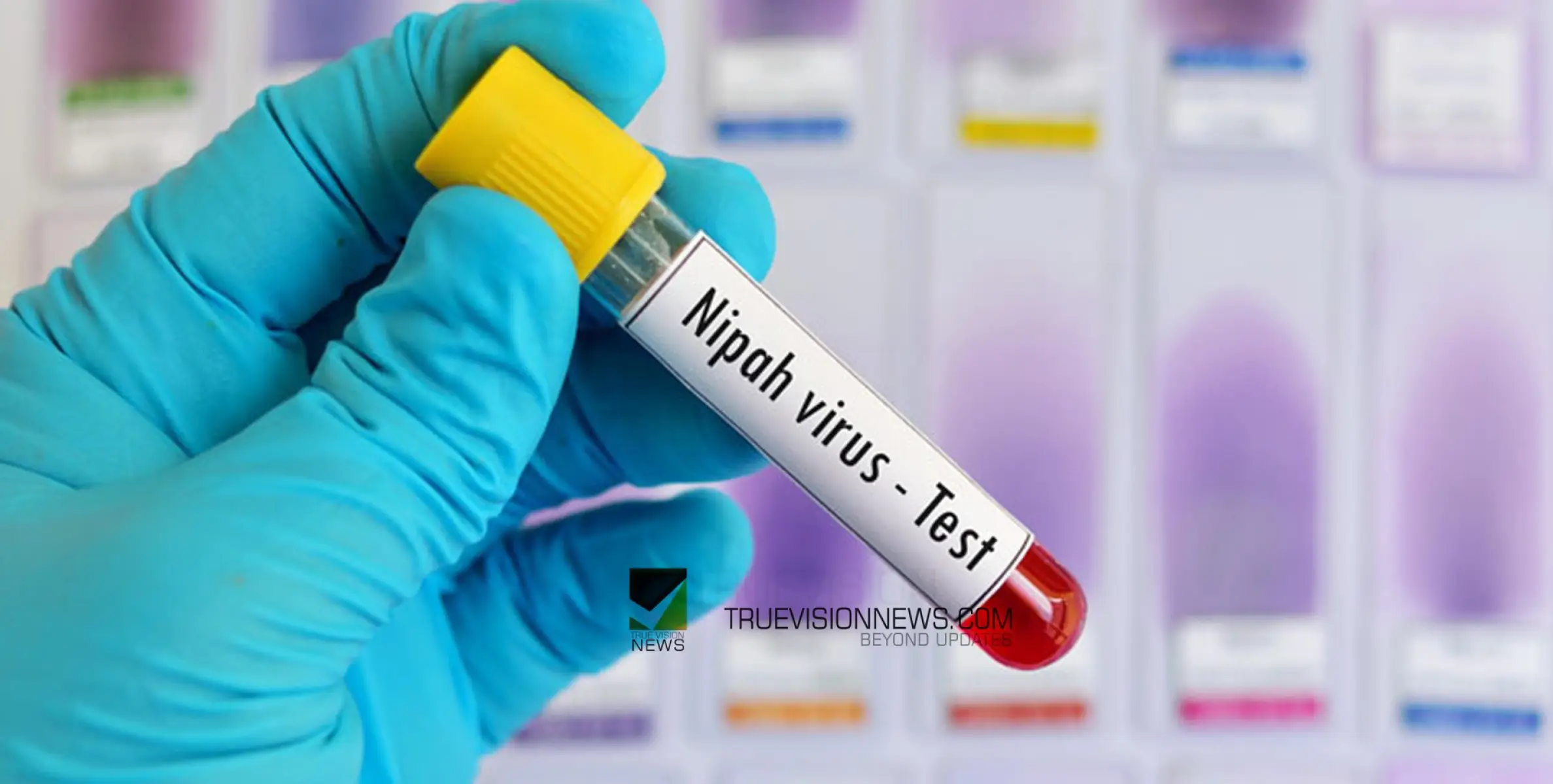 #NIPAH | നിപ പരിശോധന നടത്തുന്നത് എങ്ങനെ...? അറിയാം സംസ്ഥാനത്തെ ലാബുകളുടെ പ്രവർത്തനം 