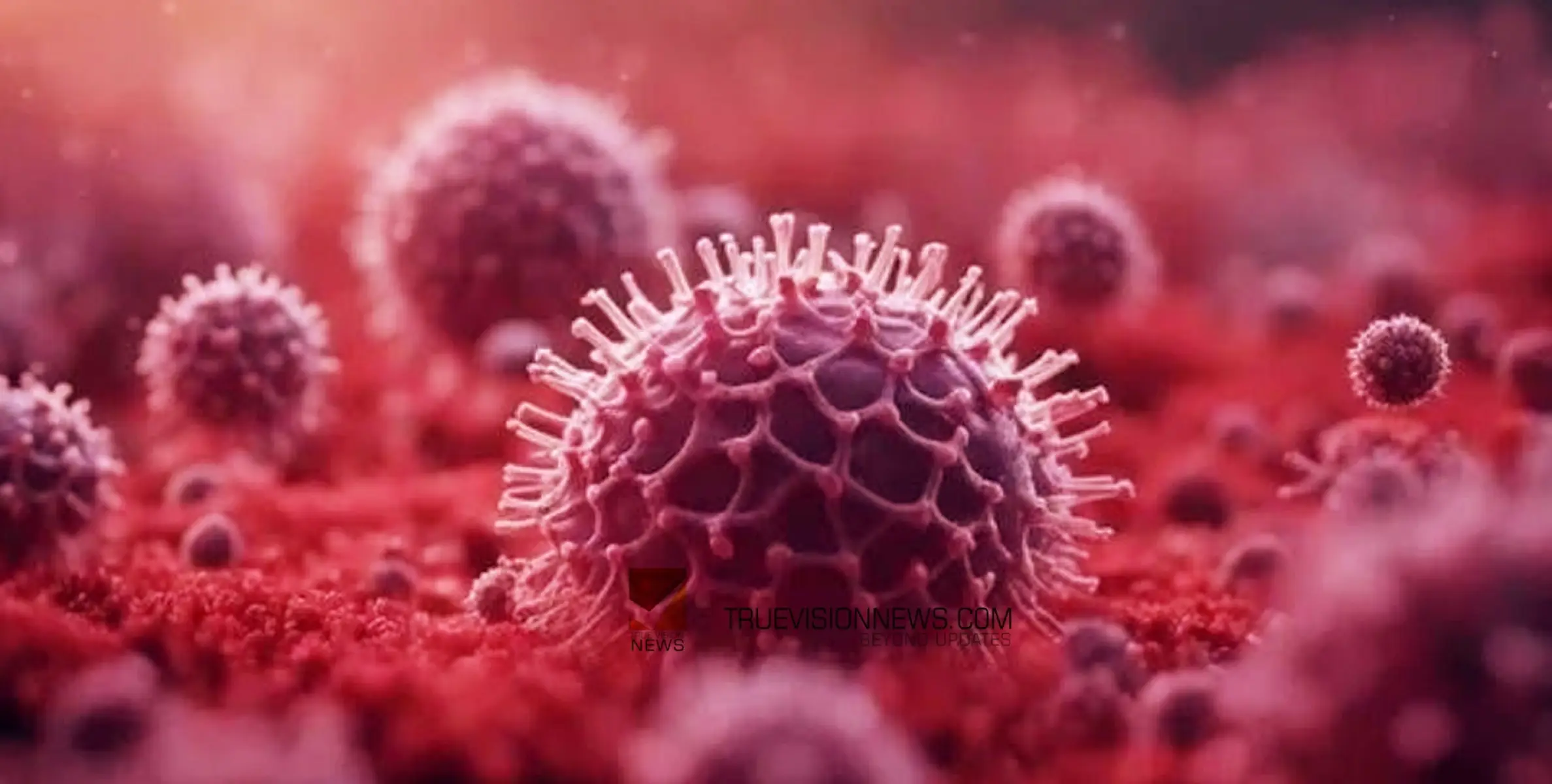 #NIPAH | നിപ; കോഴിക്കോട് എൻ.ഐ.ടിയിലും നിയന്ത്രണം, പരീക്ഷകൾ മാറ്റി