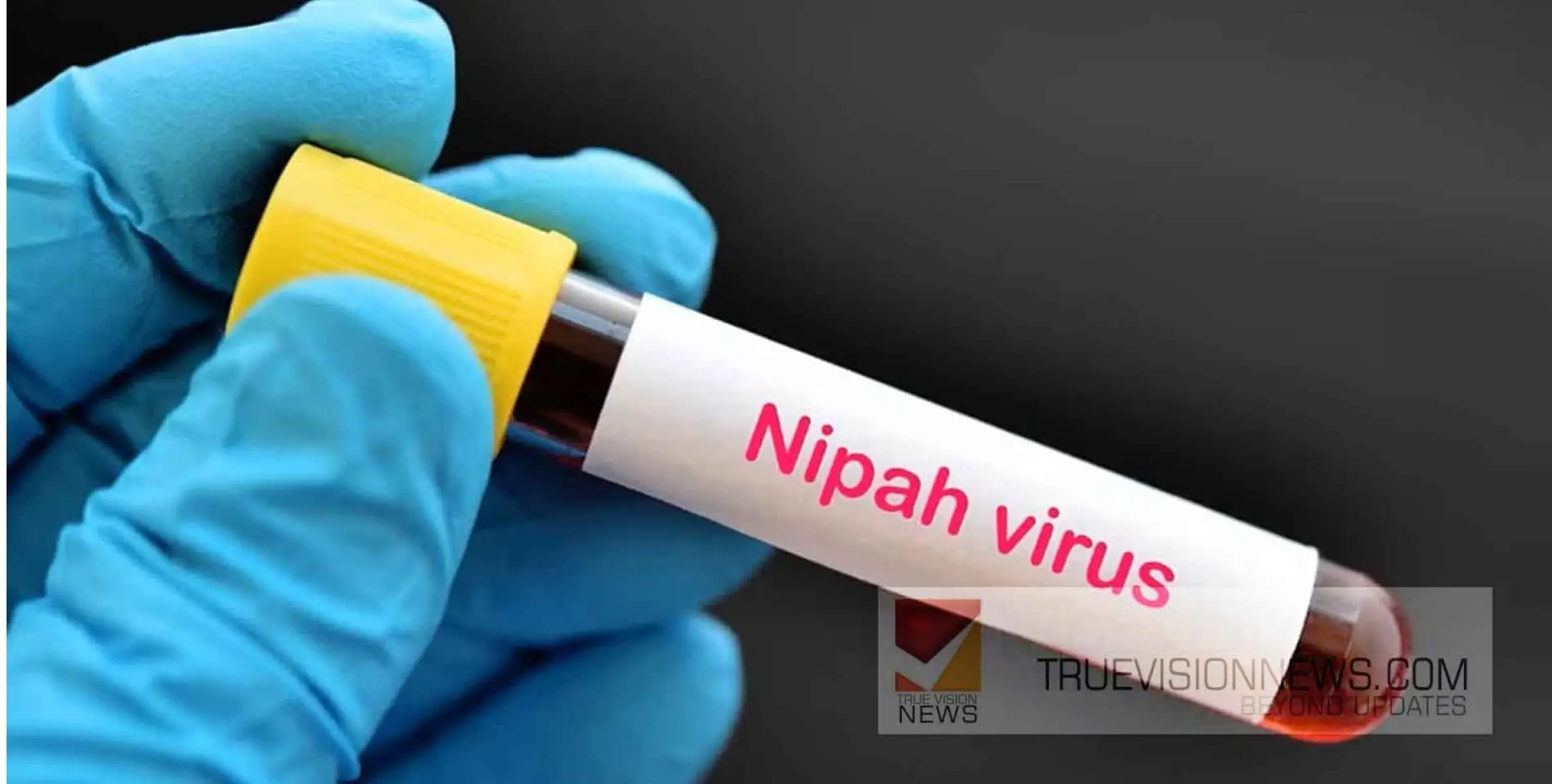 #nipah|  നിപ ; ഹൈ റിസ്ക് സമ്പർക്കമുള്ള 61 പേരുടെ ഫലം നെഗറ്റീവ് 