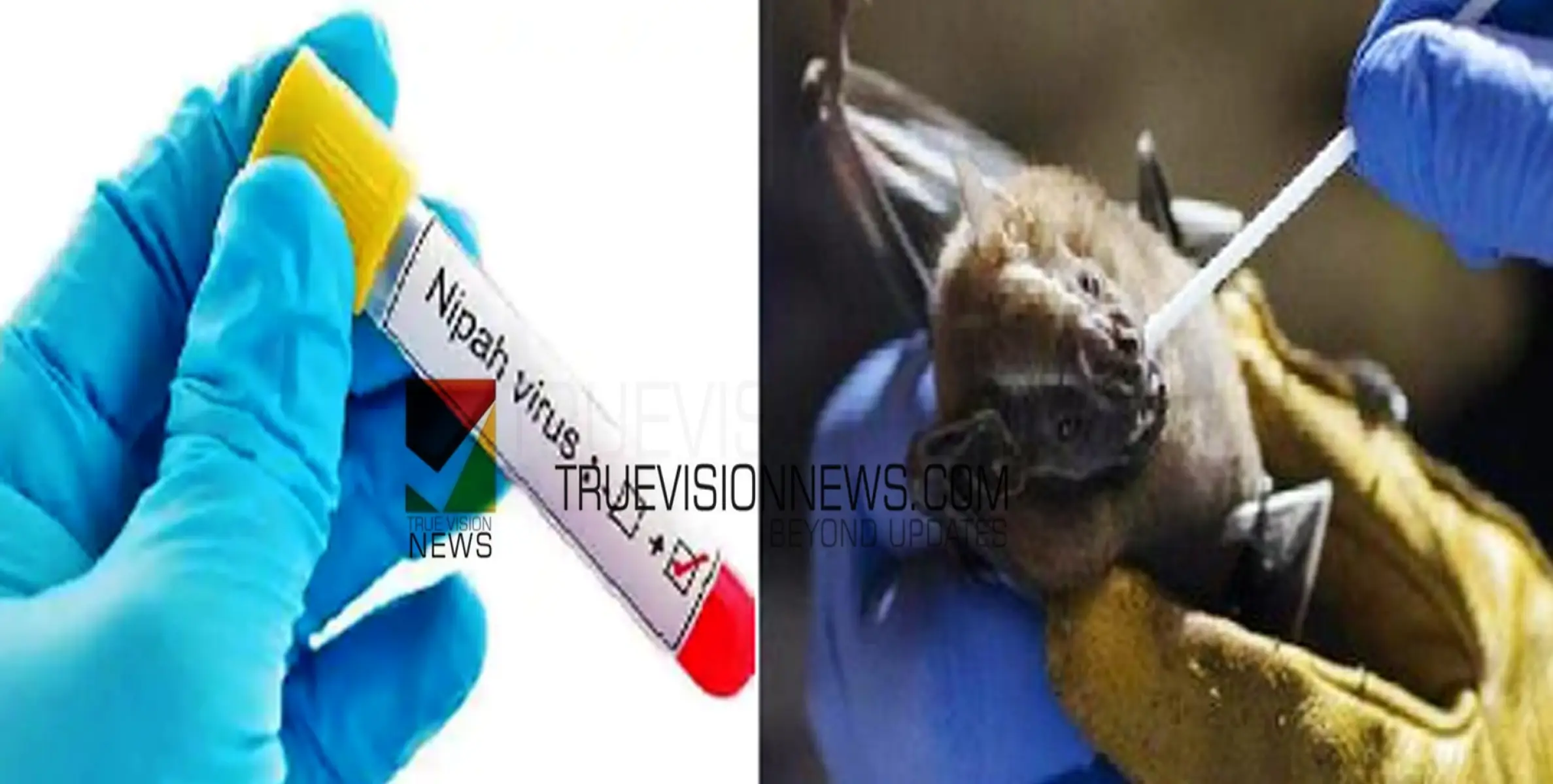 #nipah | നിപ; കുറ്റ്യാടിയിൽ  സാമ്പിൾ ശേഖരണം തുടരും