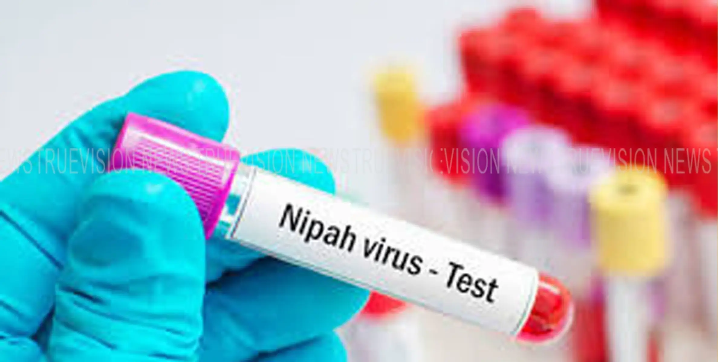 #Nipah|നിപ ആശങ്ക നീങ്ങുന്നു ; പരിശോധന ഫലങ്ങളെല്ലാം നെഗറ്റീവ്