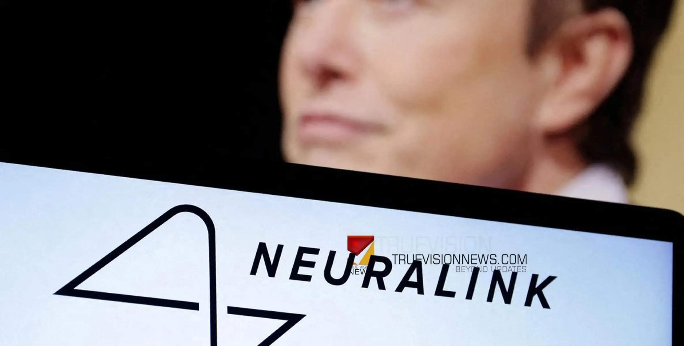 #Neuralink | മസ്കിന്റെ ന്യൂറാലിങ്ക് ചിപ്പ് ആദ്യമായി മനുഷ്യരില്‍ പരീക്ഷിക്കുന്നു; ക്ലിനിക്കൽ ട്രയലിനായി എഫ്‌ഡിഎയുടെ അംഗീകാരം ലഭിച്ചതായി കമ്പനി