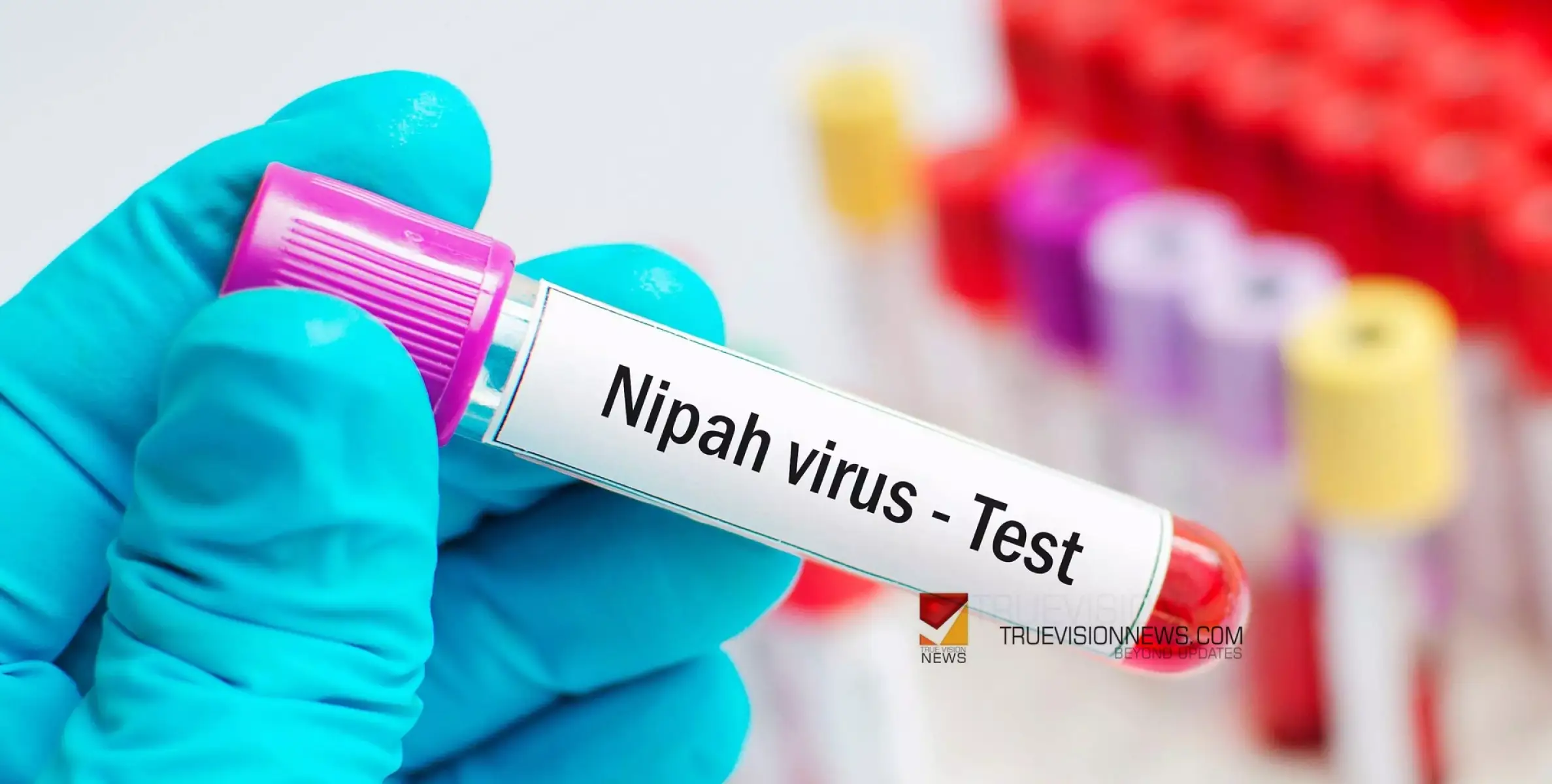 #nipah | നിപ: നിയന്ത്രണങ്ങള്‍ സംബന്ധിച്ച് വിദഗ്ധ സമിതി നാളെ നിര്‍ദേശം നല്‍കും