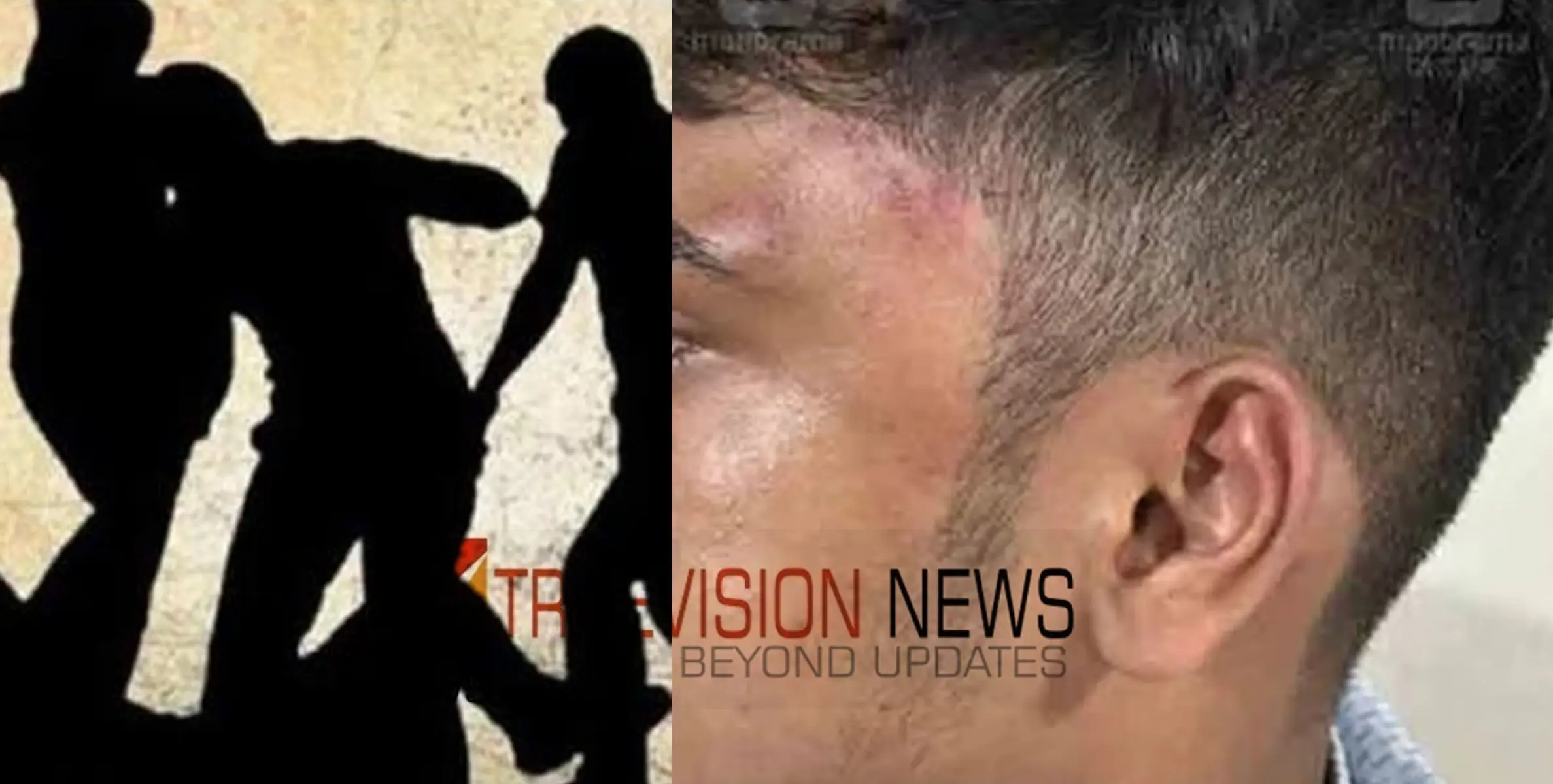 #brutallybeaten | കോഴിക്കോട് പ്ലസ് വൺ വിദ്യാർഥിയെ പ്ലസ്ടു വിദ്യാർഥികൾ ക്രൂരമായി മർദ്ദിച്ചതായി പരാതി 