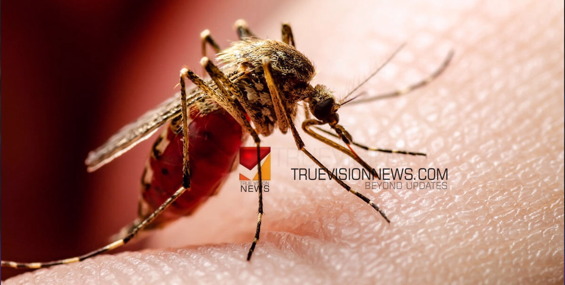 #Denguefever | കോഴിക്കോട് ജില്ലയില്‍ ഡെങ്കിപ്പനി കേസുകള്‍ കൂടുന്നു; മുന്നറിയിപ്പുമായി ആരോഗ്യ വകുപ്പ് 