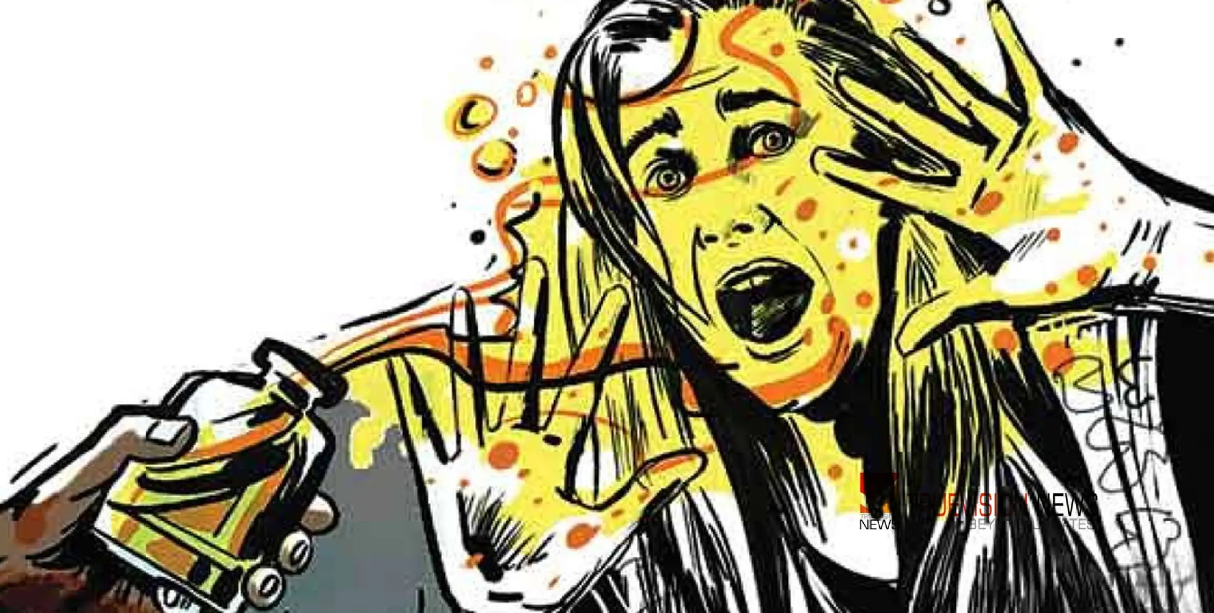 #Acidattack |ദില്ലിയിൽ പ്രായപൂർത്തിയാകാത്ത പെൺകുട്ടിക്ക് നേരെ ആസിഡ് ആക്രമണം