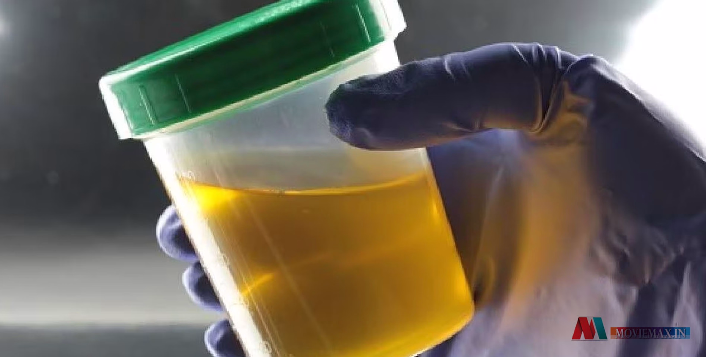 #viral | സ്വന്തം മൂത്രം ആരാധകർക്ക് വിൽക്കുന്ന മോഡൽ; മൂത്രമൊഴിക്കുന്ന വീഡിയോ സ്പെഷലായി ചെയ്തുകൊടുക്കും! 