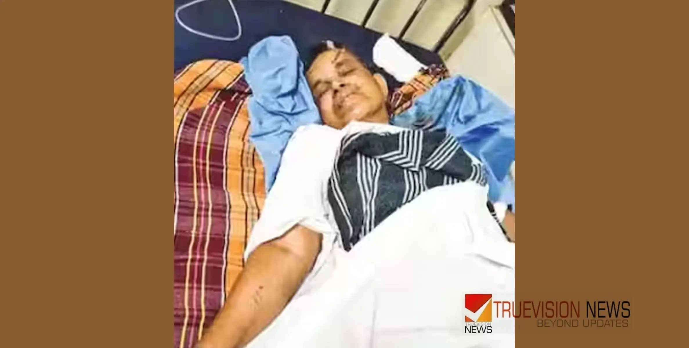 #stabbed|  പുലർച്ചെ ശബ്ദം കേട്ട് എഴുന്നേറ്റു, നിലവിളിച്ചപ്പോൾ കത്തി വീശി കള്ളൻ, വെട്ടേറ്റ വയോധിക ചികിത്സയിൽ