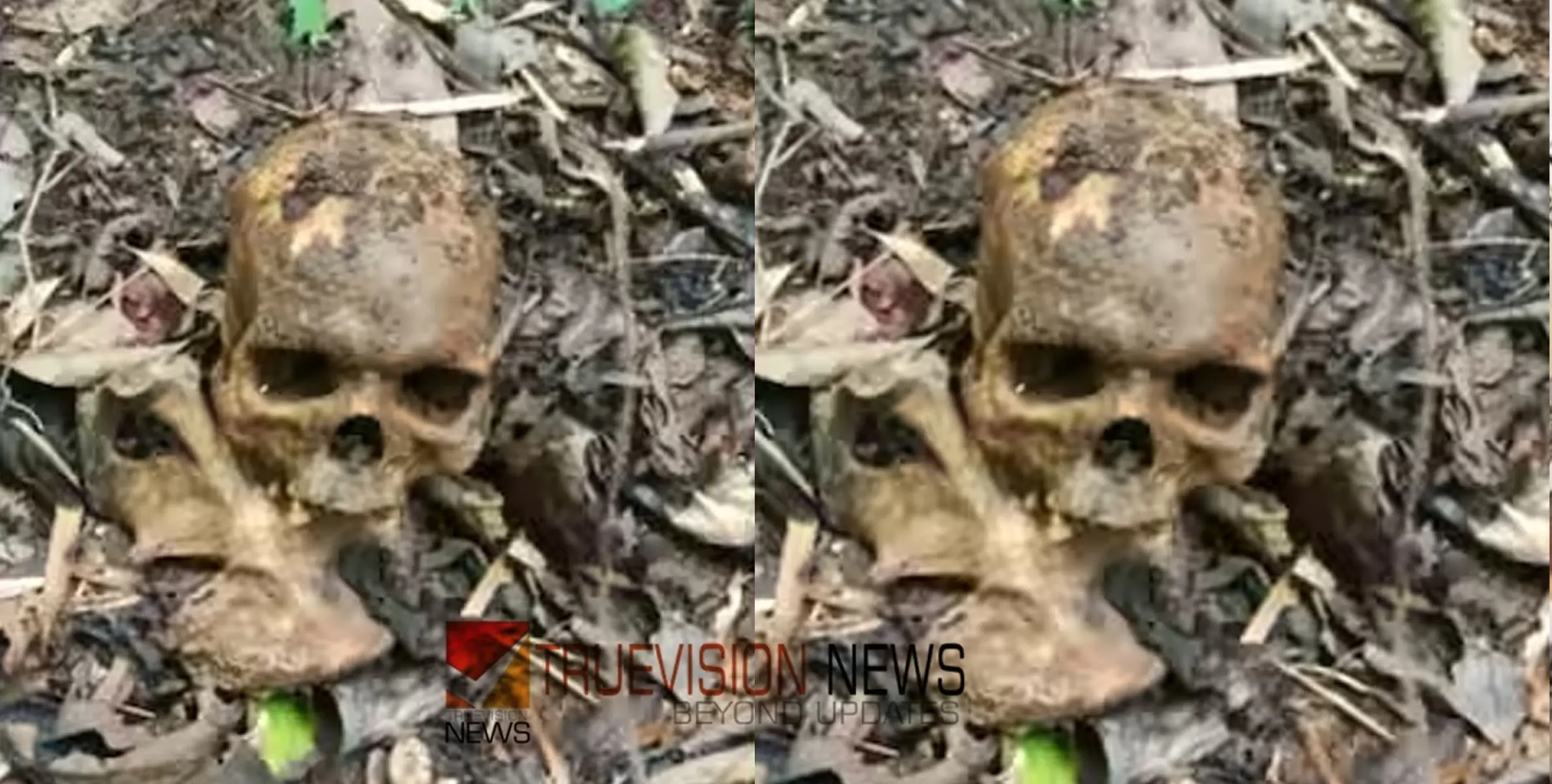 #humanskull  | വനത്തില്‍ അസ്ഥികൂടം കണ്ടെത്തിയ സംഭവം; സമീപത്ത് പഴക്കമുള്ള ഷര്‍ട്ടും മദ്യകുപ്പിയും