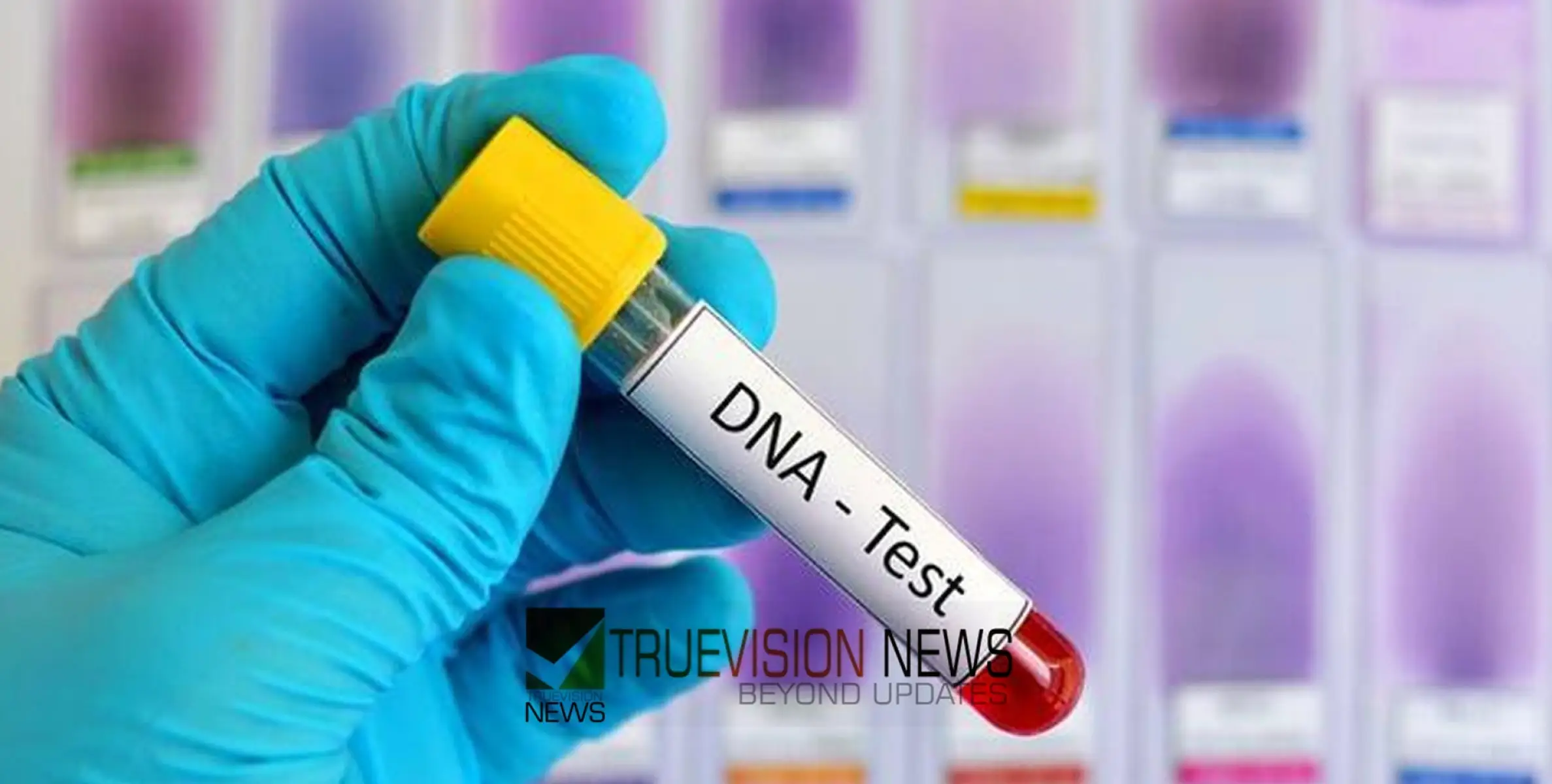 #dna | കുട്ടിയുടെ പിതൃത്വം സംശയിച്ച് പിതാവ്; വനിതാ കമ്മീഷന്റെ ഉത്തരവിൽ ഡിഎൻഎ പരിശോധന നടത്തി പിതൃത്വം തെളിയിച്ചു