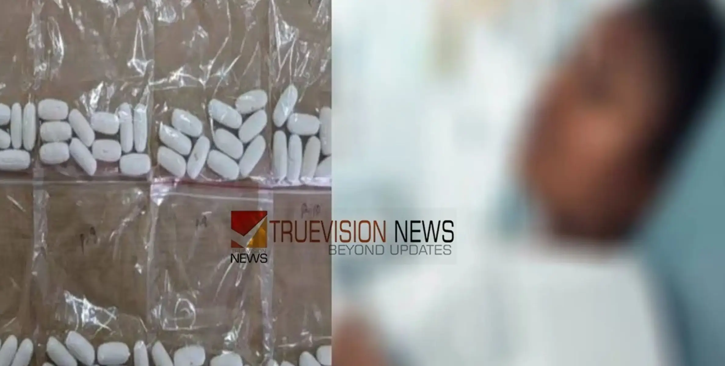 #cocaine | ക്യാപ്സൂള്‍ രൂപത്തില്‍ വിഴുങ്ങിയത് 30 കോടിയുടെ കൊക്കെയ്ൻ; യുവതിയുടെ അറസ്റ്റ് രേഖപ്പെടുത്തി 