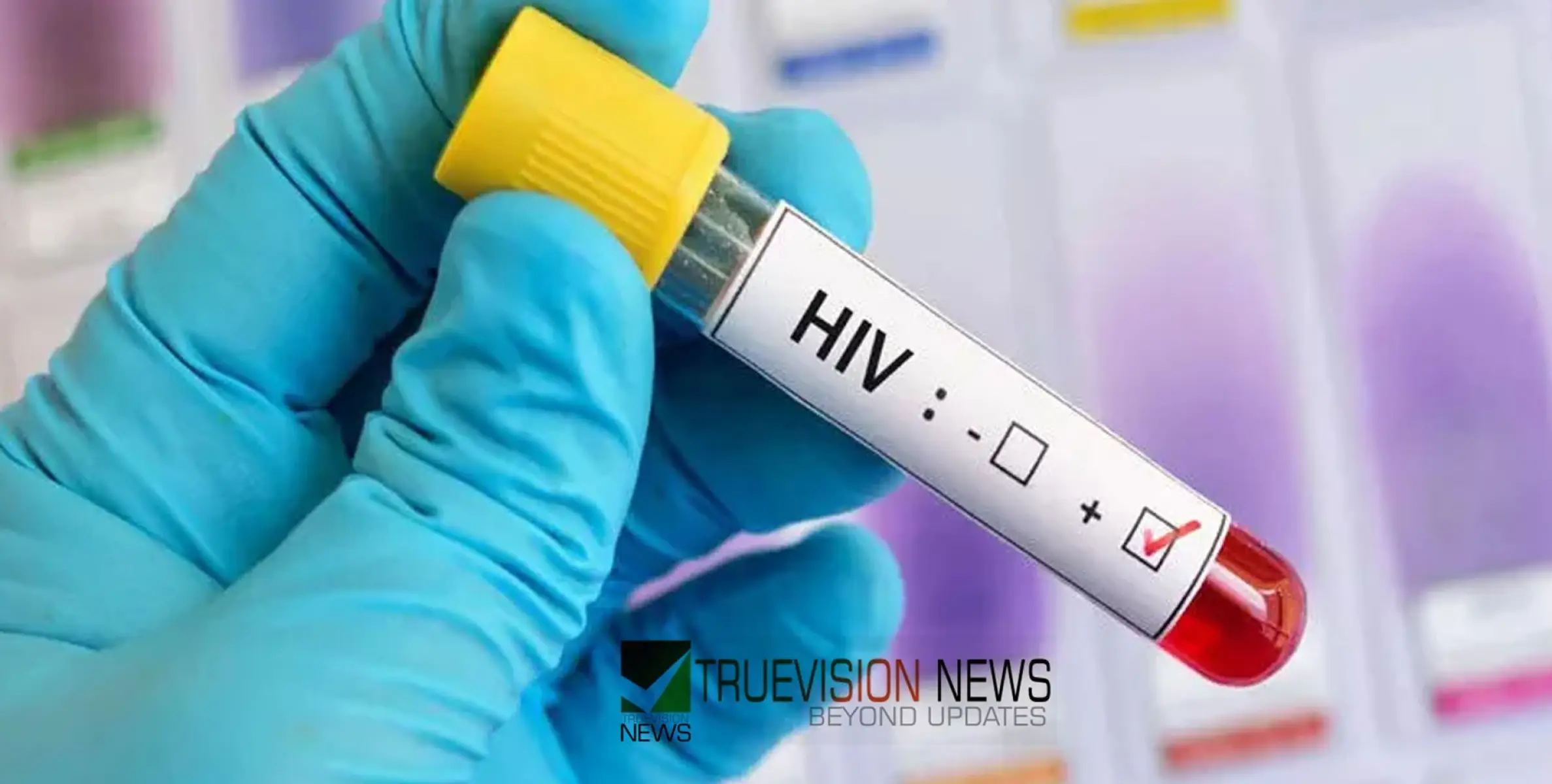 #HIV | ക​ഴി​ഞ്ഞ വ​ർ​ഷം ഒ​മാ​നി​ൽ റി​പ്പോ​ർ​ട്ട്​ ചെ​യ്ത​ത് 221 എ​ച്ച്.​ഐ.​വി കേ​സു​ക​ൾ 