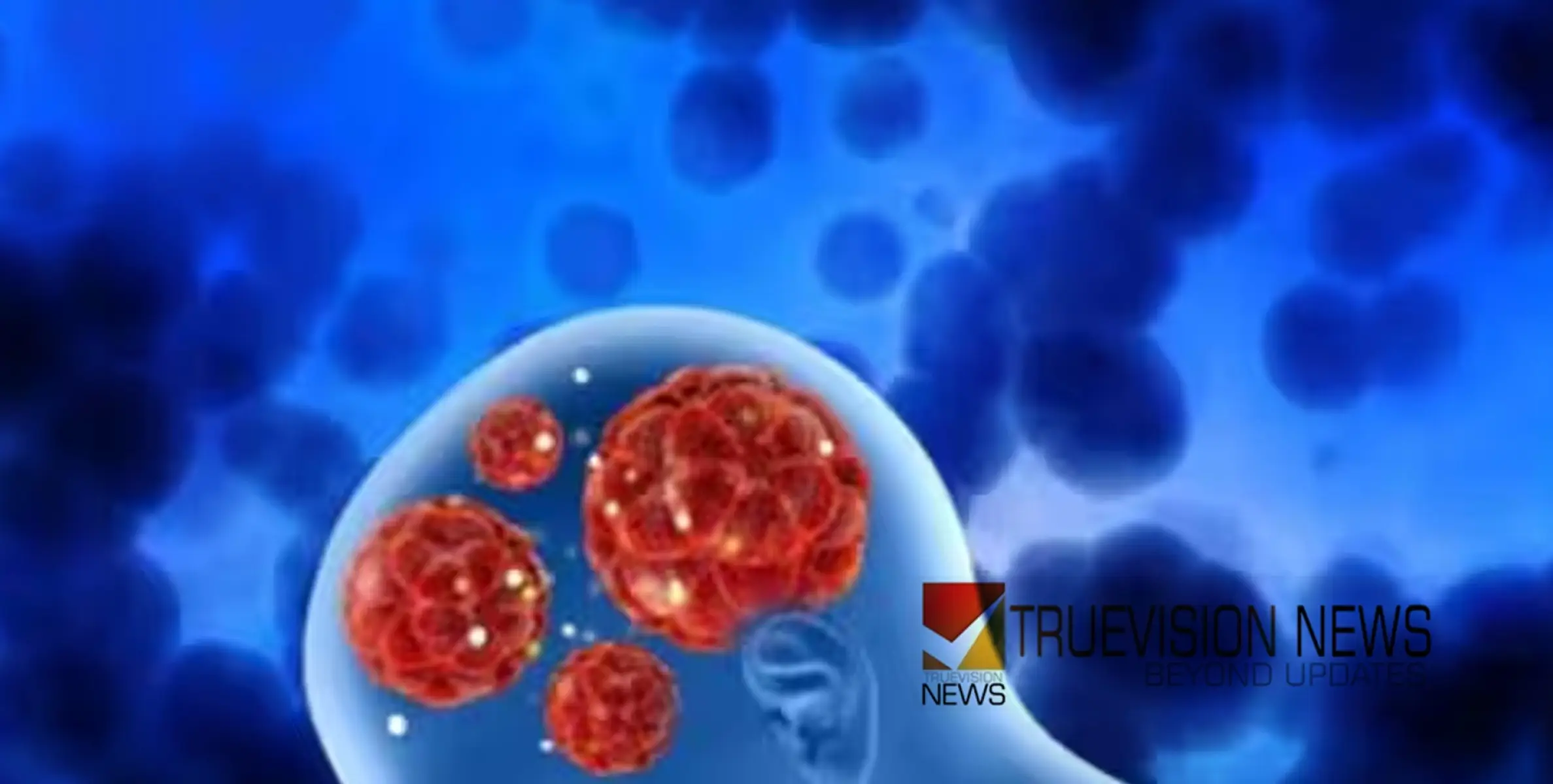 #amoebainfection |അമീബിക് മസ്തിഷ്ക ജ്വരം; ബാധിക്കുന്നത് തലച്ചോറിനെ, മരണ നിരക്ക് കൂടുതൽ, രോഗം പടരുന്നത് എങ്ങനെ? മുൻകരുതൽ വേണം