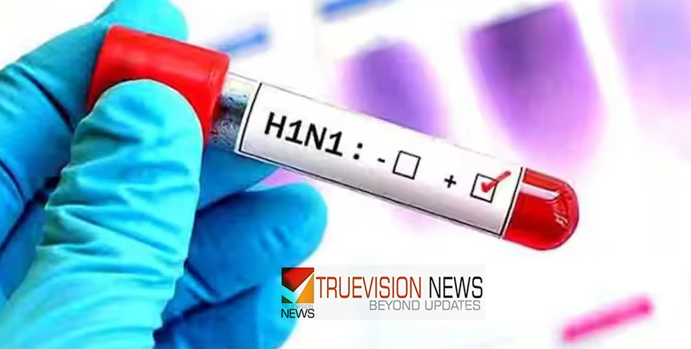  #H1N1 | മലപ്പുറത്ത്  ഒരാൾക്ക് എച്ച്‍വൺഎൻവൺ; ലക്ഷണങ്ങൾ കണ്ടാൽ റിപ്പോർട്ട് ചെയ്യണം