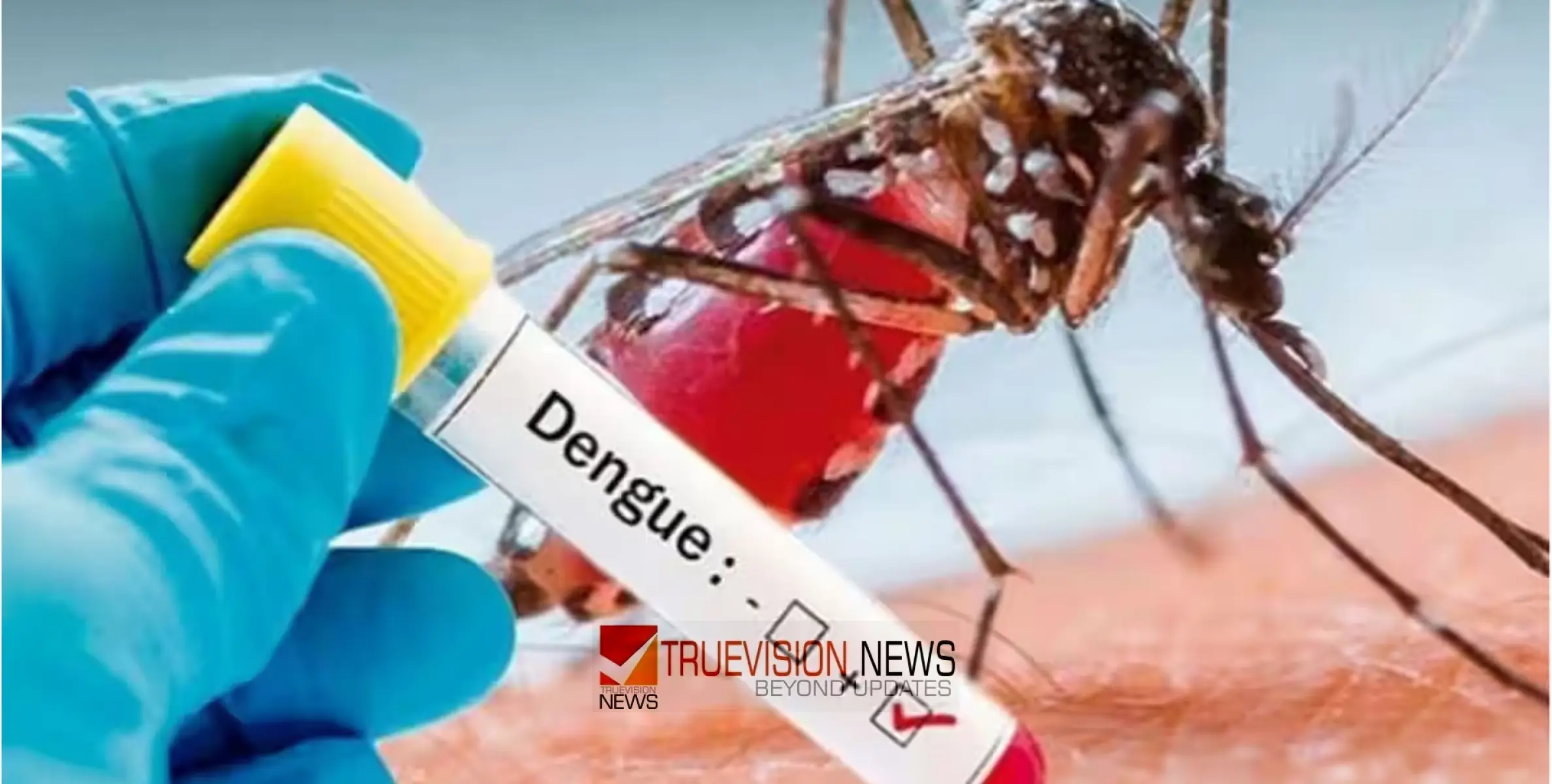 #Denguefever |  ഈ മഴക്കാലത്ത് ഡെങ്കിപ്പനിയെ സൂക്ഷിക്കുക ; ലക്ഷണങ്ങൾ എന്തൊക്കെ ? എങ്ങനെ പ്രതിരോ​ശോധിക്കാം...