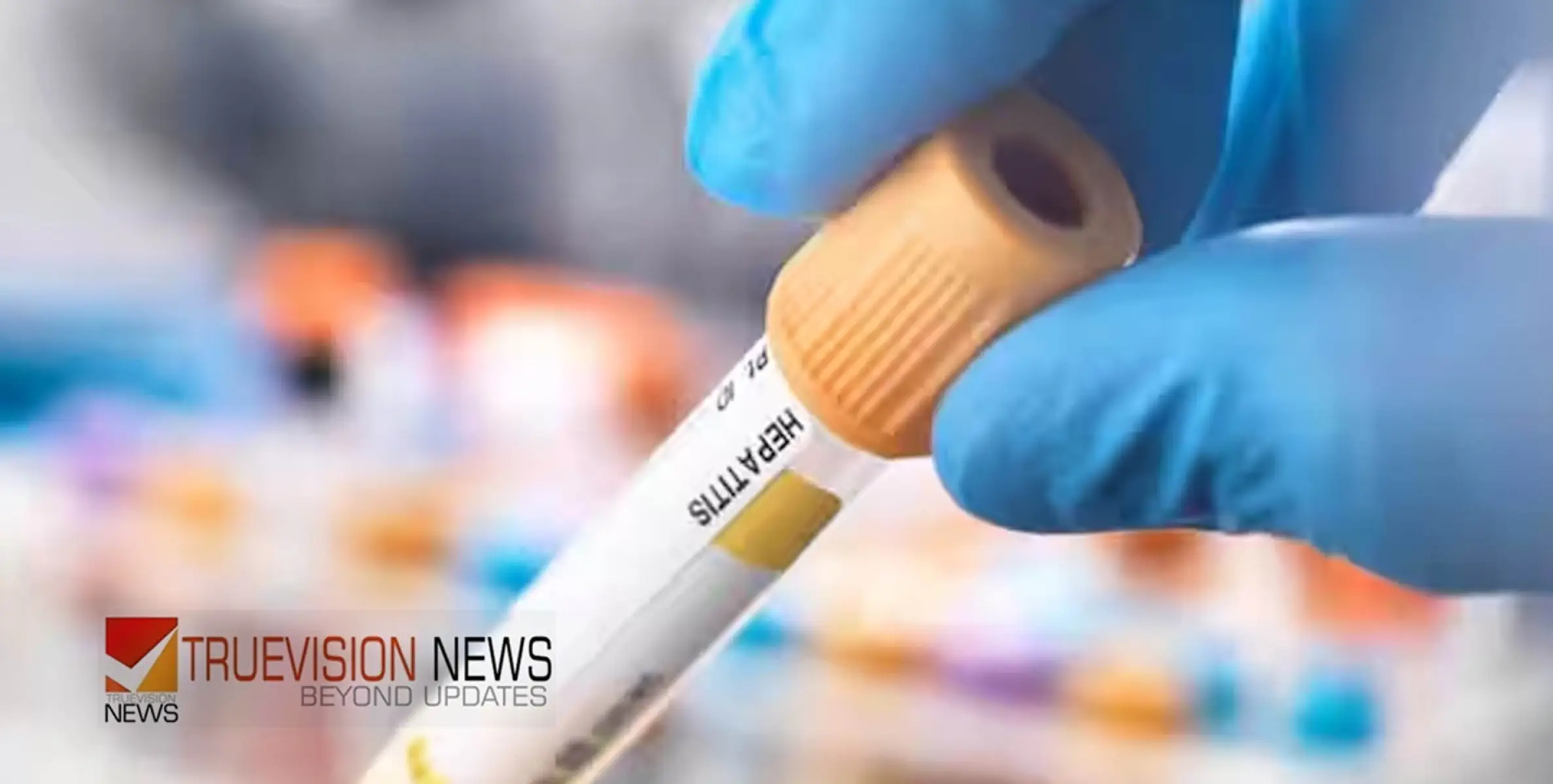 #jaundice |  മേമുണ്ട ഹയർ സെക്കന്ററി സ്കൂളിലെ 23വിദ്യാർത്ഥികൾക്ക് മഞ്ഞപ്പിത്തം സ്ഥിരീകരിച്ചു