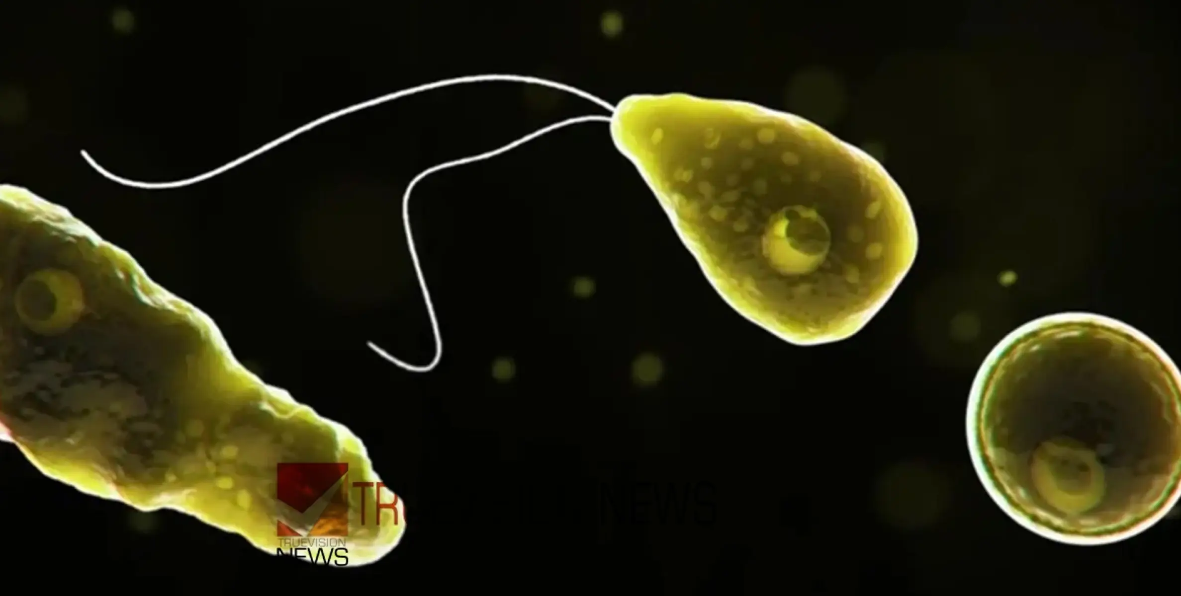 #amoebicmeningoencephalitis | അമീബിക് മസ്തിഷ്കജ്വരം ബാധിച്ച മൂന്നര വയസുകാരന്റെ ആരോഗ്യനില ഗുരുതരം