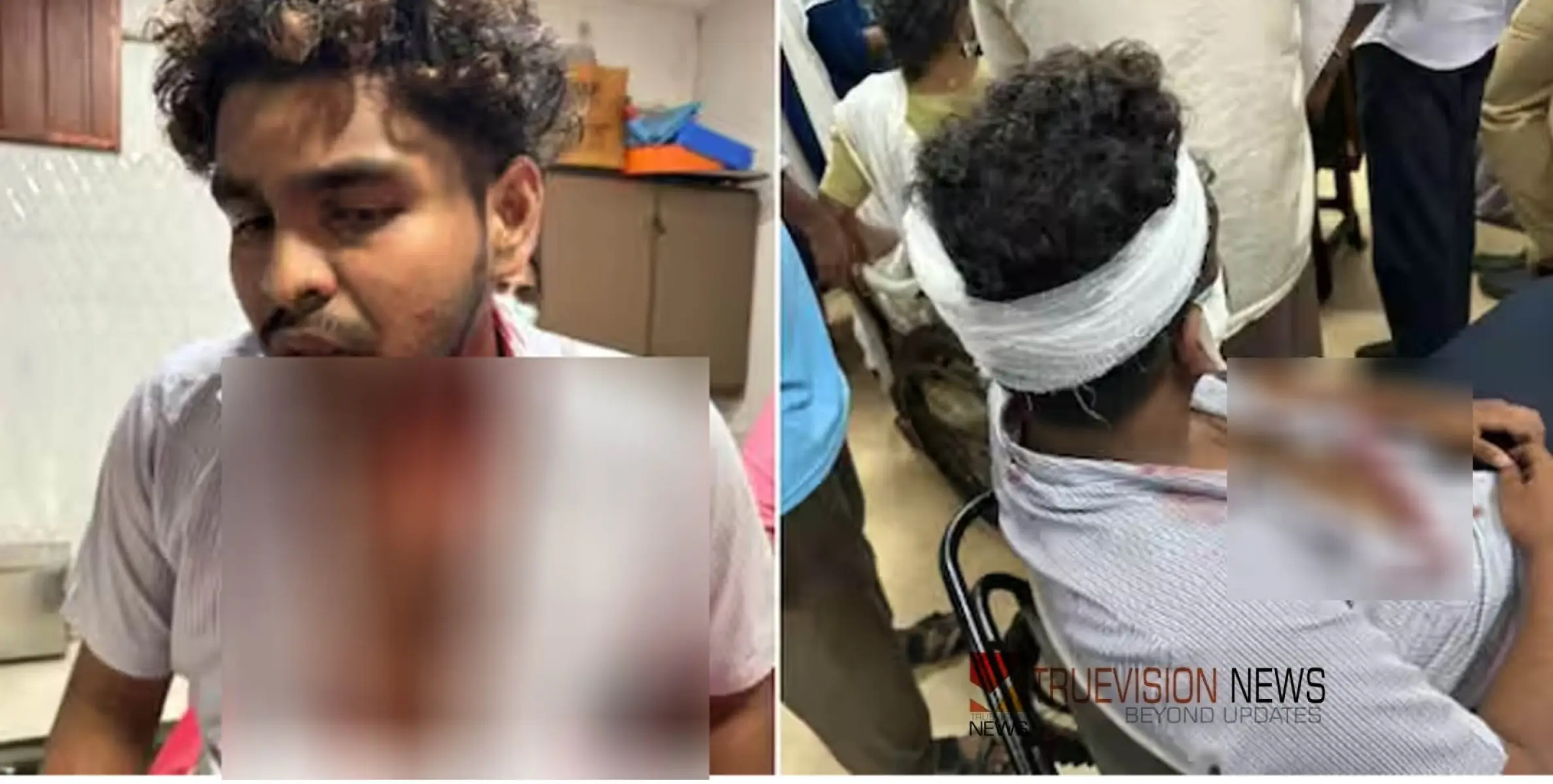 #beaten |  ബൈക്ക് തടഞ്ഞ് ചാവി കൊണ്ട് കുത്തിപ്പരിക്കേൽപ്പിച്ചു; വിദ്യാർഥിക്ക് സീനിയർ വിദ്യാർഥികളുടെ ക്രൂരമർദ്ദനമെന്ന് പരാതി