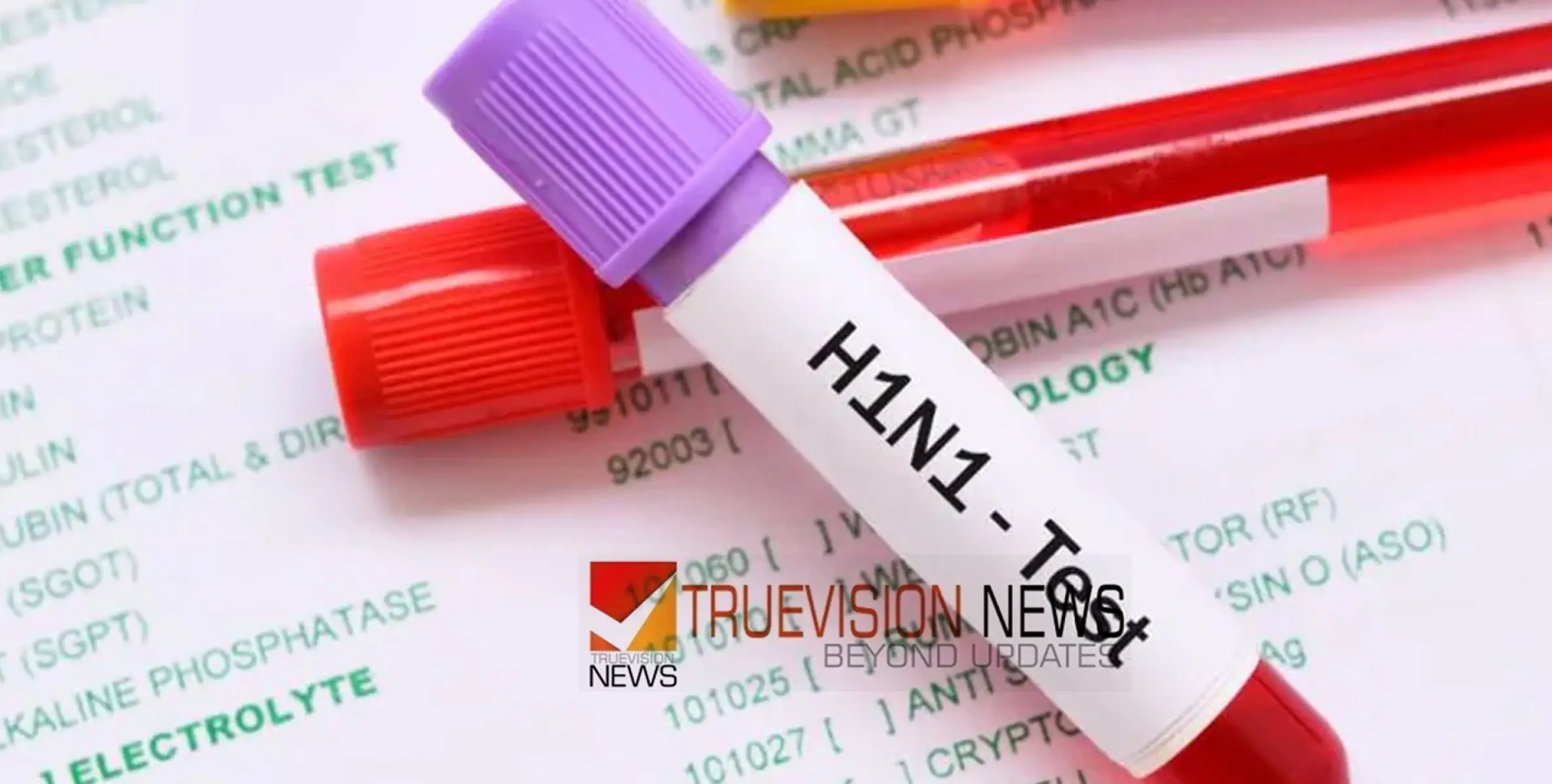 #h1n1 | കോതമംഗലത്ത് ബാങ്ക് ജീവനക്കാർക്കും ബന്ധുവിനും എച്ച്.വൺ എൻ.വൺ, എട്ട് പേർ നിരീക്ഷണത്തിൽ