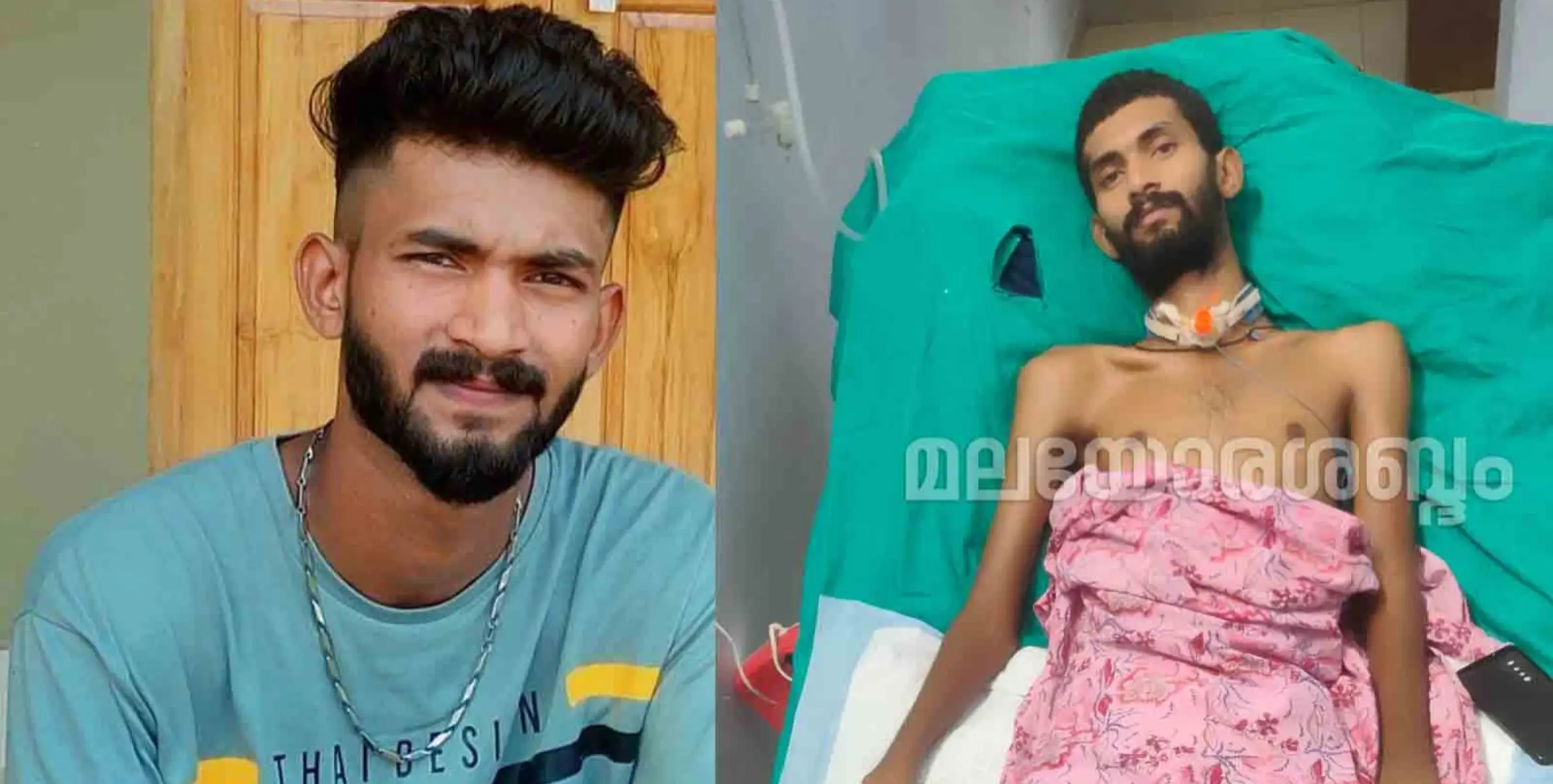 കാട്ടാനയുടെ അക്രമണത്തിൽ പരിക്കേറ്റ് ചികിത്സയിൽ കഴിയുന്ന വൈഷ്ണവിനായി ചികിത്സാസഹായ കമ്മിറ്റി രൂപീകരിച്ചു 