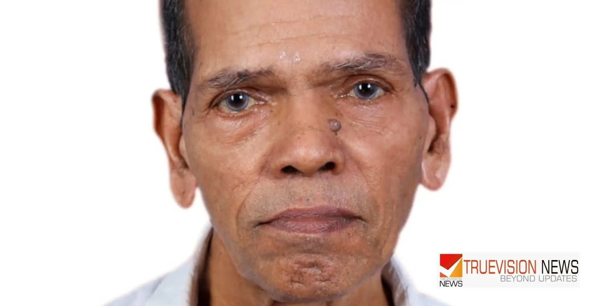 #obituary |  എച്ചിലുള്ള കണ്ടി അപ്പുക്കുറുപ്പ് അന്തരിച്ചു 