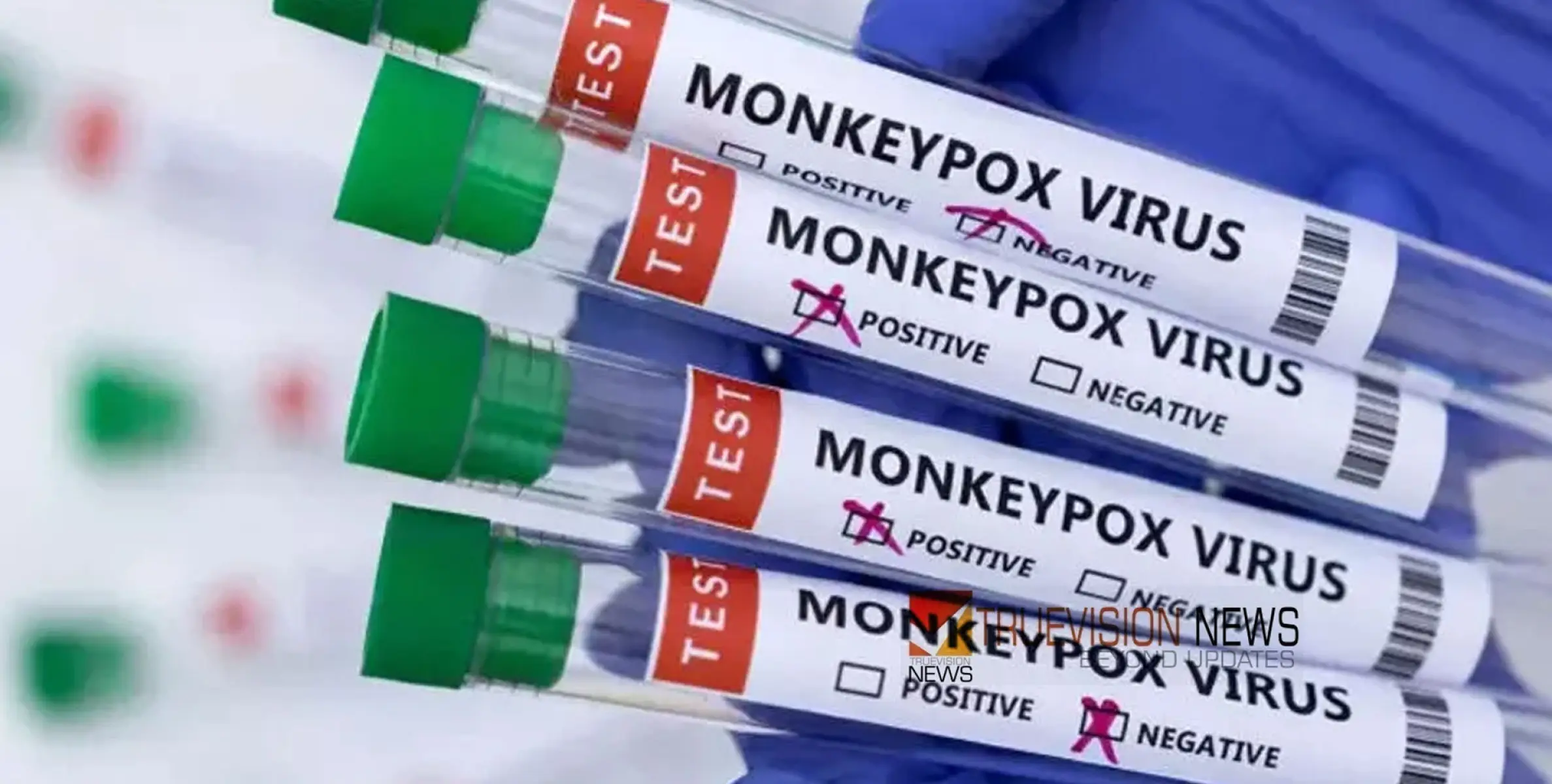 #Monkeypox | മ​ങ്കി​പോ​ക്സ്: സൂ​ക്ഷ്മ​മാ​യി നി​രീ​ക്ഷി​ച്ചു വ​രു​ന്ന​താ​യി ആ​രോ​ഗ്യ മ​ന്ത്രാ​ല​യം 