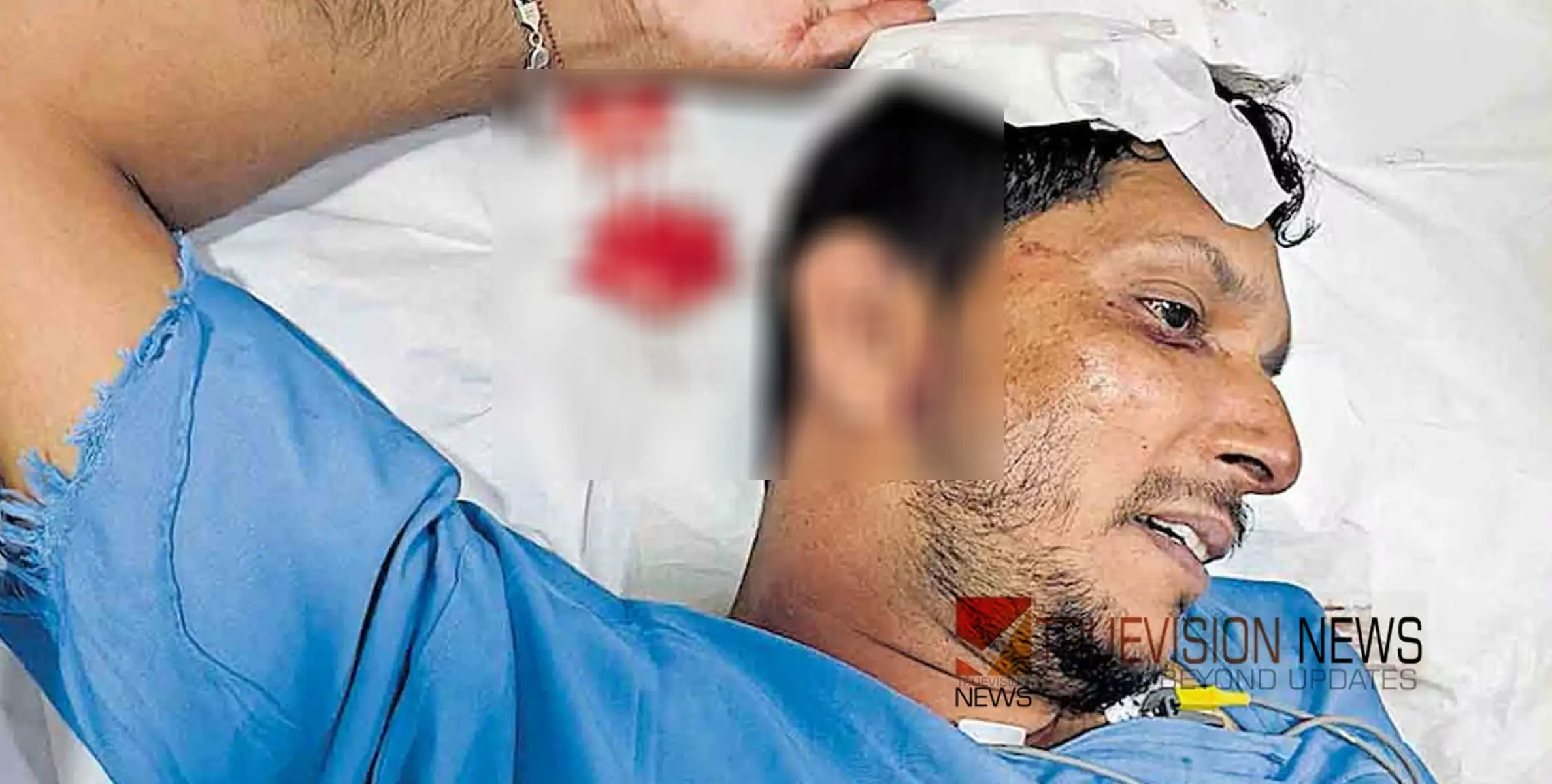 #attack | കണ്ണൂരിൽ ശോഭായാത്ര കഴിഞ്ഞ് മടങ്ങിയ ബിജെപി പ്രവർത്തകന് നേരെ ആക്രമണം 