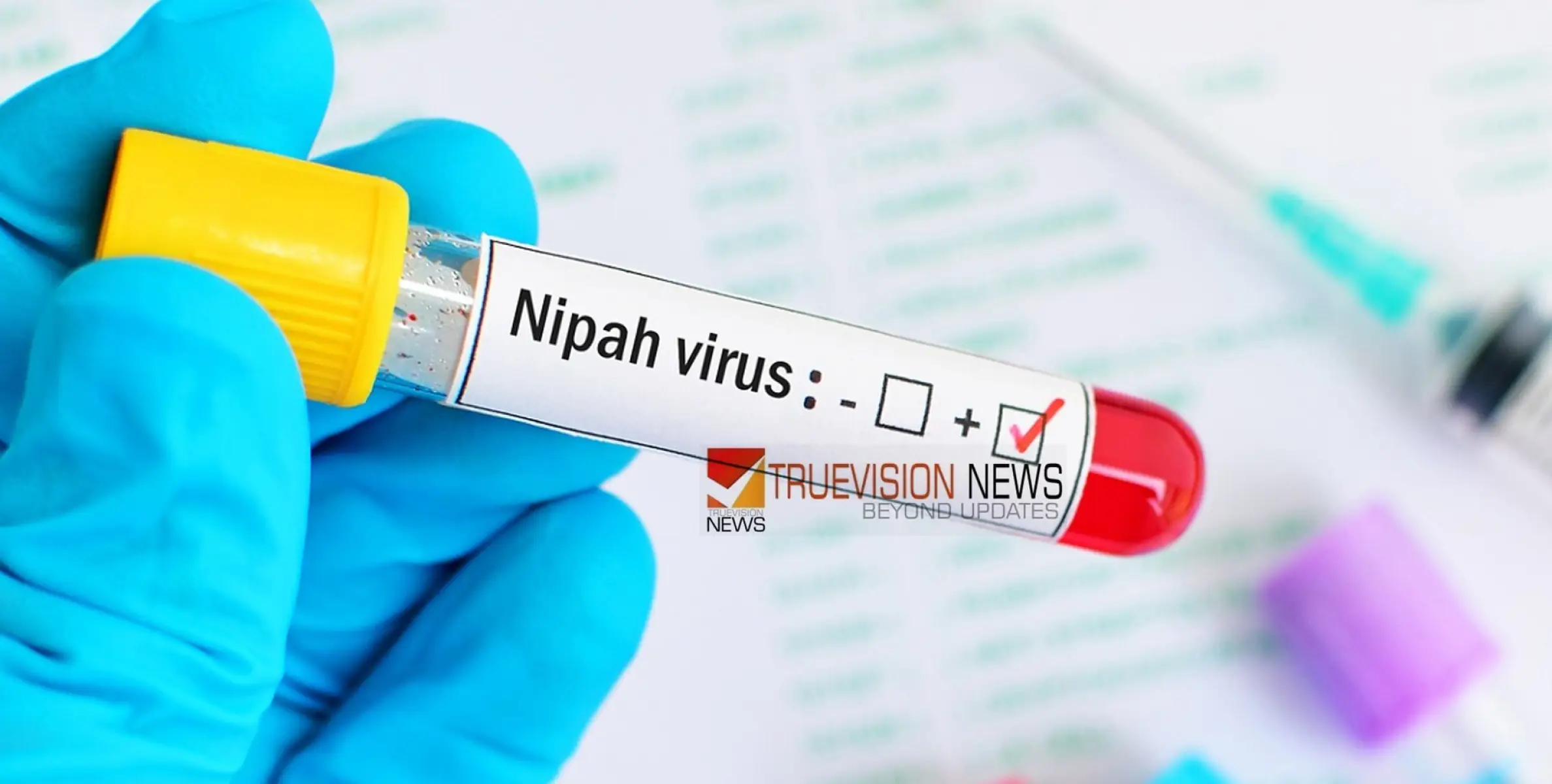 #Nipah | സംസ്ഥാനത്ത് വീണ്ടും നിപ സ്ഥിരീകരിച്ചു; മരിച്ച 24-കാരന്‍റെ പരിശോധന ഫലം പോസിറ്റീവ് 