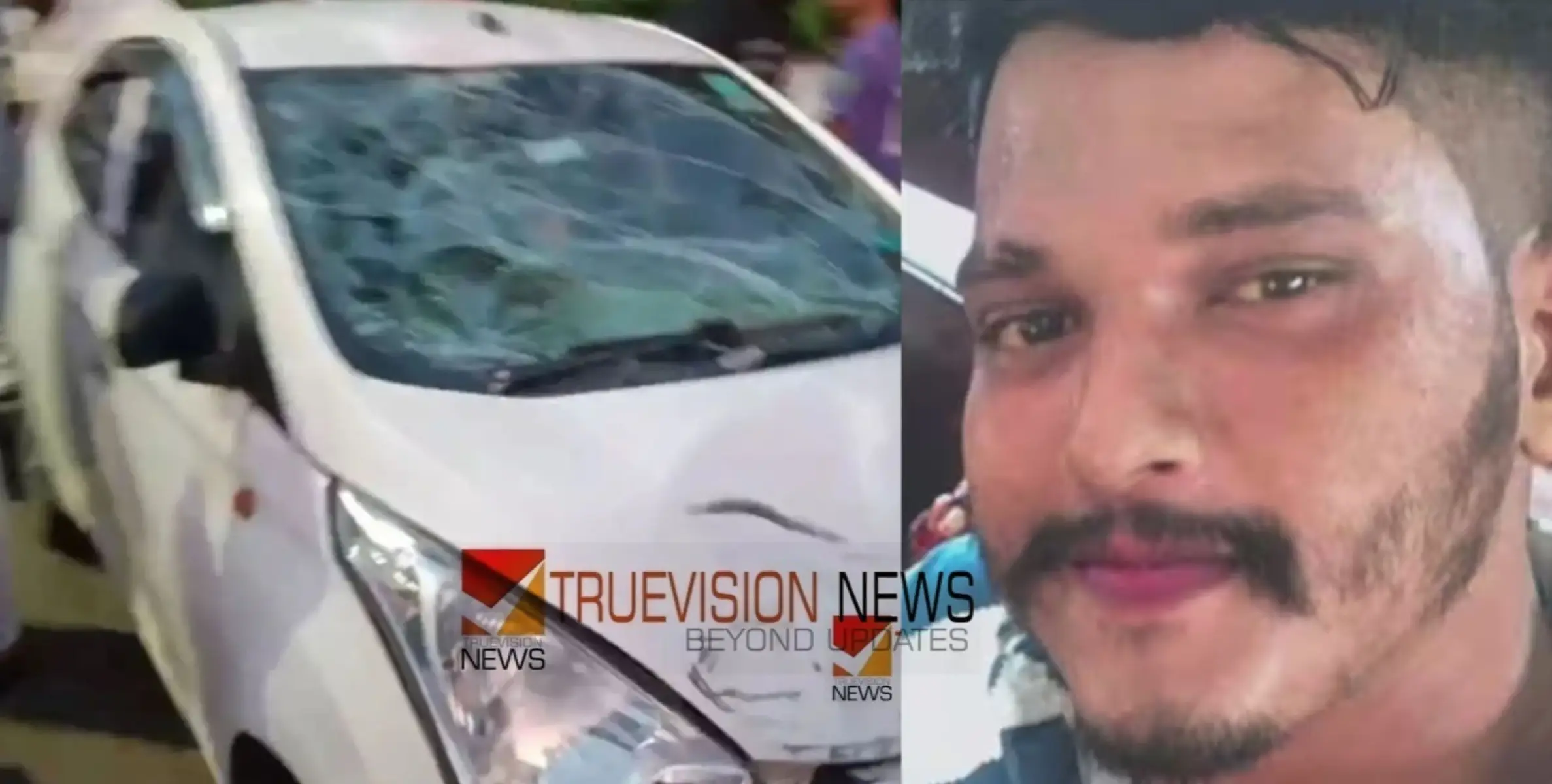 #accidentcase | പ്രതിയും യുവ ഡോക്ടറും മദ്യപിച്ചിരുന്നു, നാട്ടുകാർ ആക്രമിക്കുമോ എന്ന് ഭയന്നു; അജ്മലിനെതിരെ നേരെത്തെ ലഹരി വിൽപ്പന നടത്തിയതിനും കേസ് 