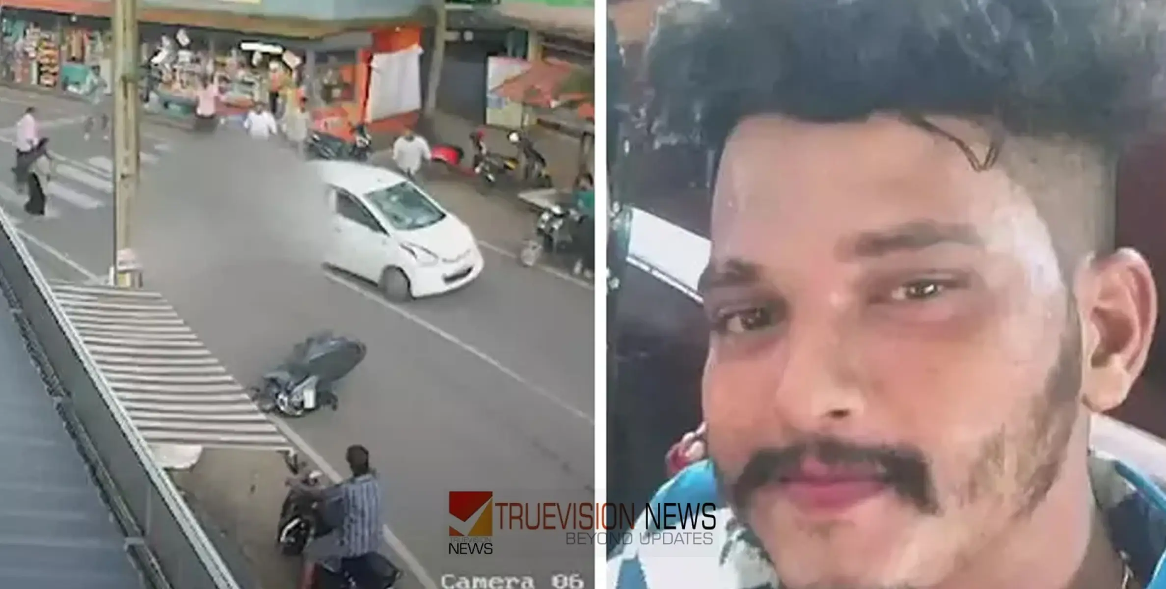 #AccidentCase | അലറി വിളിച്ച് പറഞ്ഞിട്ടും ശരീരത്തിലൂടെ കാർ കയറ്റി; അജ്മലും വനിത ഡോക്ടറും മദ്യലഹരിയിലെന്ന് ദൃക്സാക്ഷികൾ 