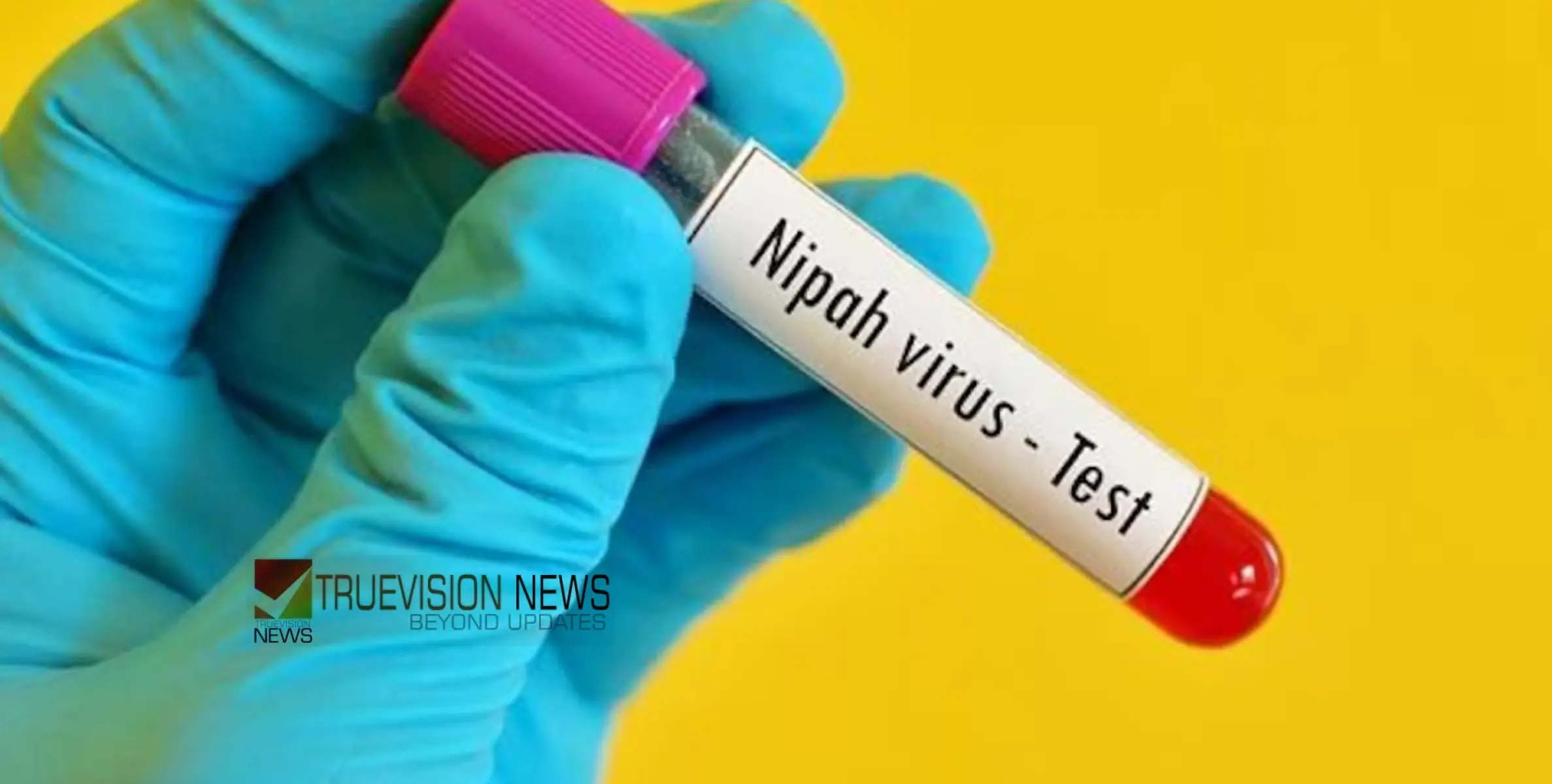 #nipah |  നിപയിൽ ആശ്വാസം; മൂന്ന് പേരുടെ പരിശോധനാ ഫലങ്ങള്‍ കൂടി നെഗറ്റീവ്