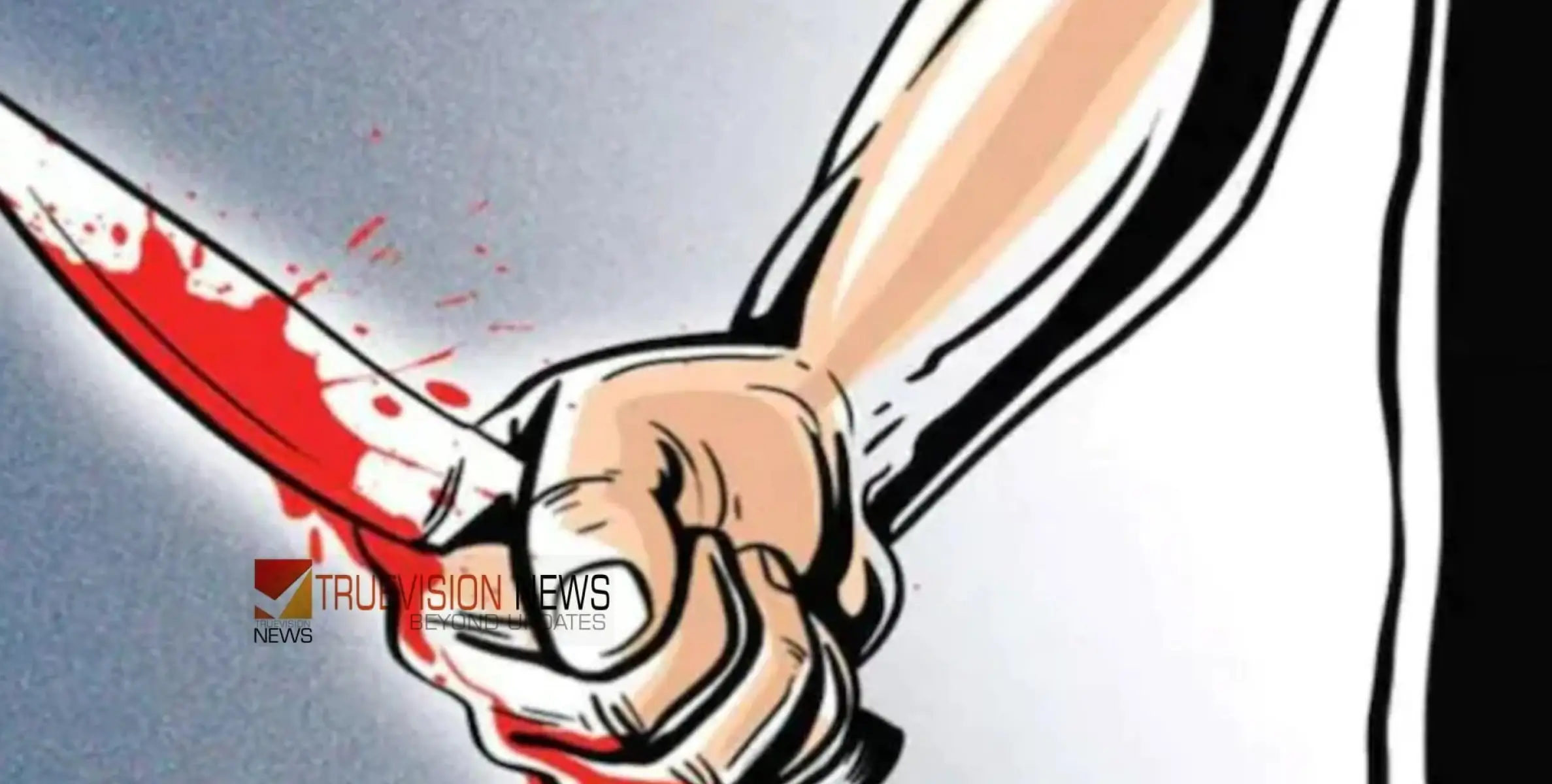 #stabbed |  കണ്ണൂരിൽ പിറന്നാൾ ആഘോഷിക്കാനെത്തിയ സംഘങ്ങൾ തമ്മിൽ ഏറ്റുമുട്ടി; രണ്ട് പേർക്ക് കുത്തേറ്റു