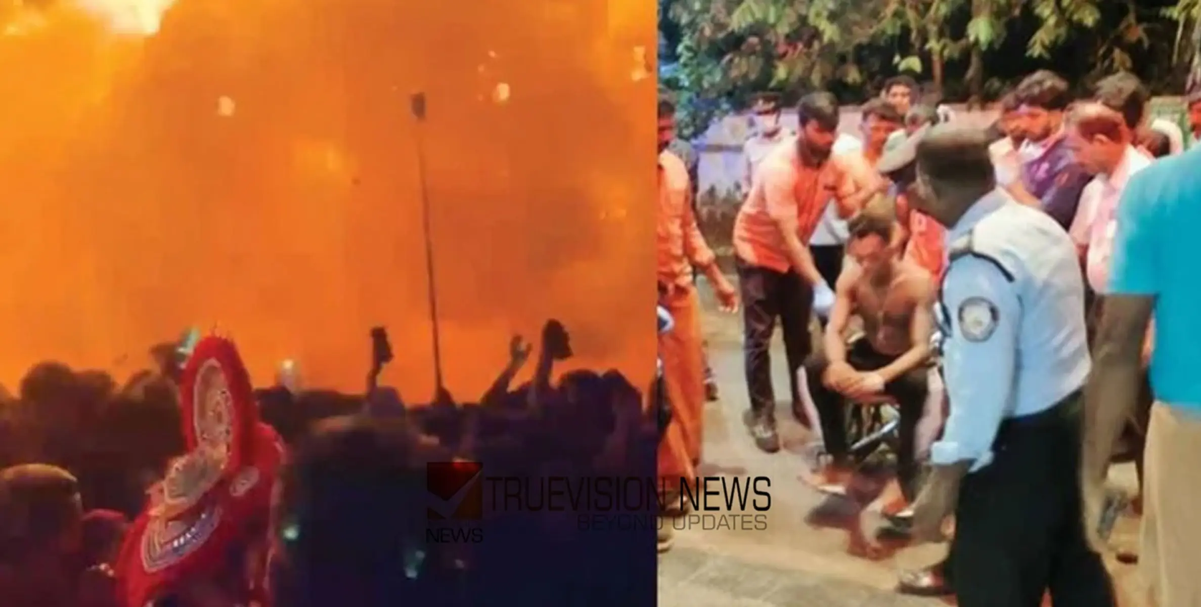 #firecrackerblast |  നീലേശ്വരം വെടിക്കെട്ടപകടം; പൊള്ളലേറ്റ നാല് വയസുകാരി പ്രാർത്ഥന അപകടനില തരണം ചെയ്‌തു, എട്ട് പേരുടെ നില ​ഗുരുതരമായി തുടരുന്നു 