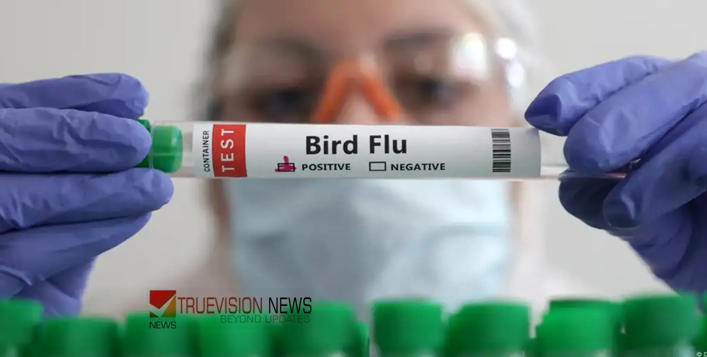 #H5N1birdflu | കൗമാരക്കാരനിൽ എച്ച്5എൻ1 പക്ഷിപ്പനി വൈറസ്ബാധ സ്ഥിരീകരിച്ചു