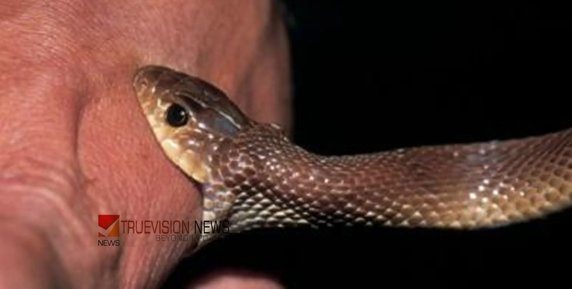 #snakebite | പാമ്പ് കടിയേറ്റ ഉടൻ എന്ത് ചെയ്യണം?; ശ്രദ്ധിക്കാം ഈക്കാര്യങ്ങൾ