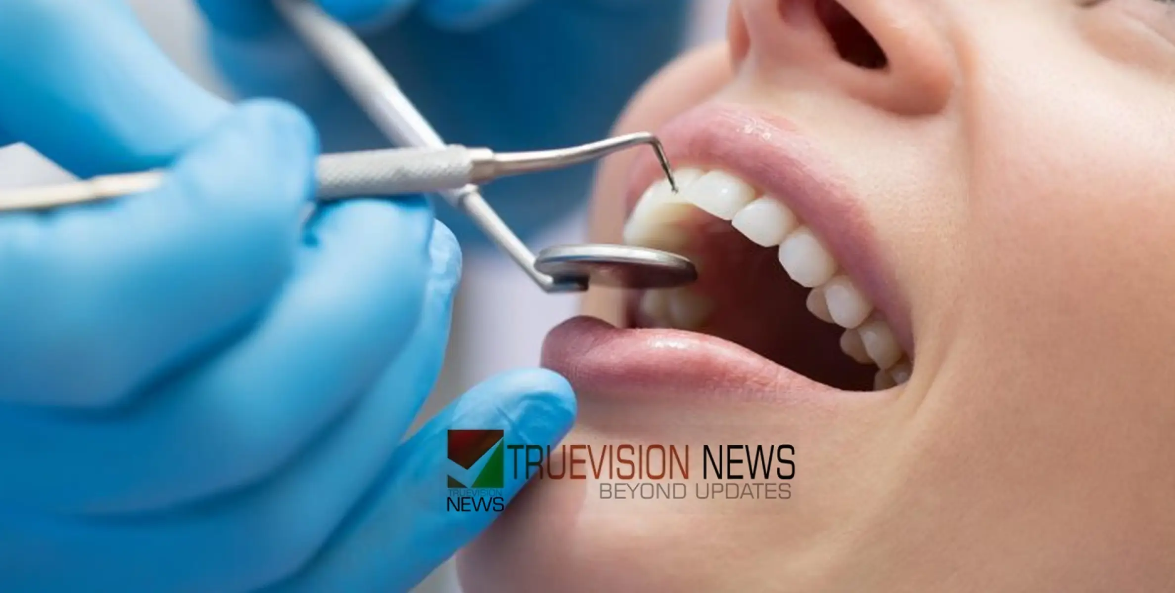 #dentist | പിഴവുകൾ തുടർകഥയായി, പ്രവാസി ദന്തഡോക്ടറെ ആരോഗ്യമേഖലയിൽ നിന്ന് വിലക്കി സൗദി 