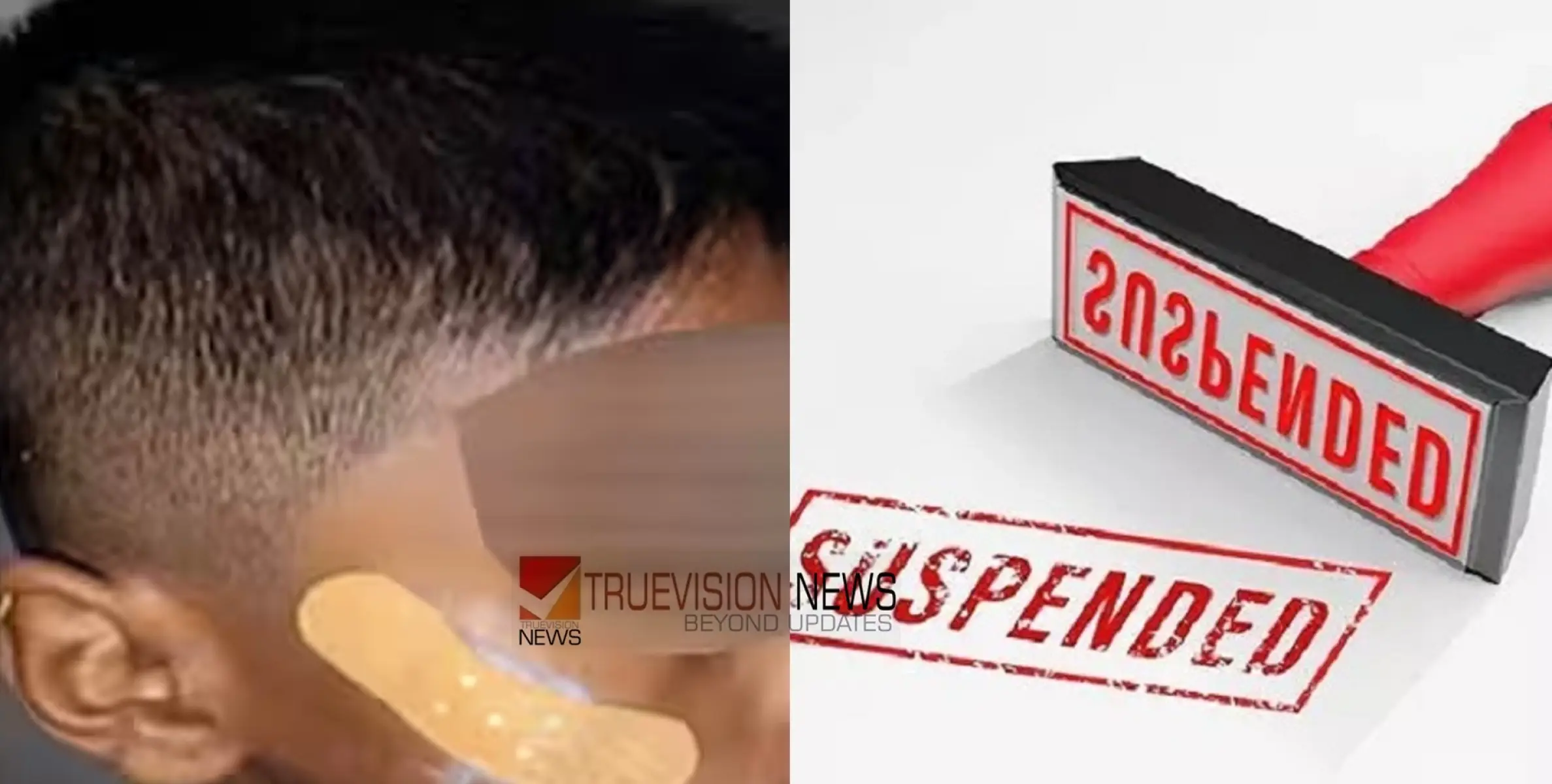 ഏഴ് വയസുകാരന്റെ മുറിവിന് തുന്നലിടുന്നതിന് പകരം ഫെവിക്വിക്ക് ഉപയോഗിച്ചു,  നഴ്സിനെ സസ്പെന്റ് ചെയ്ത് സർക്കാർ